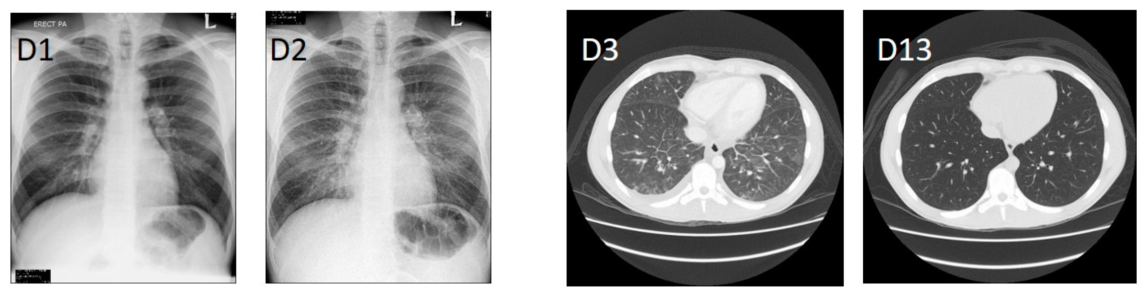 Tropicalmed 03 00029 g001