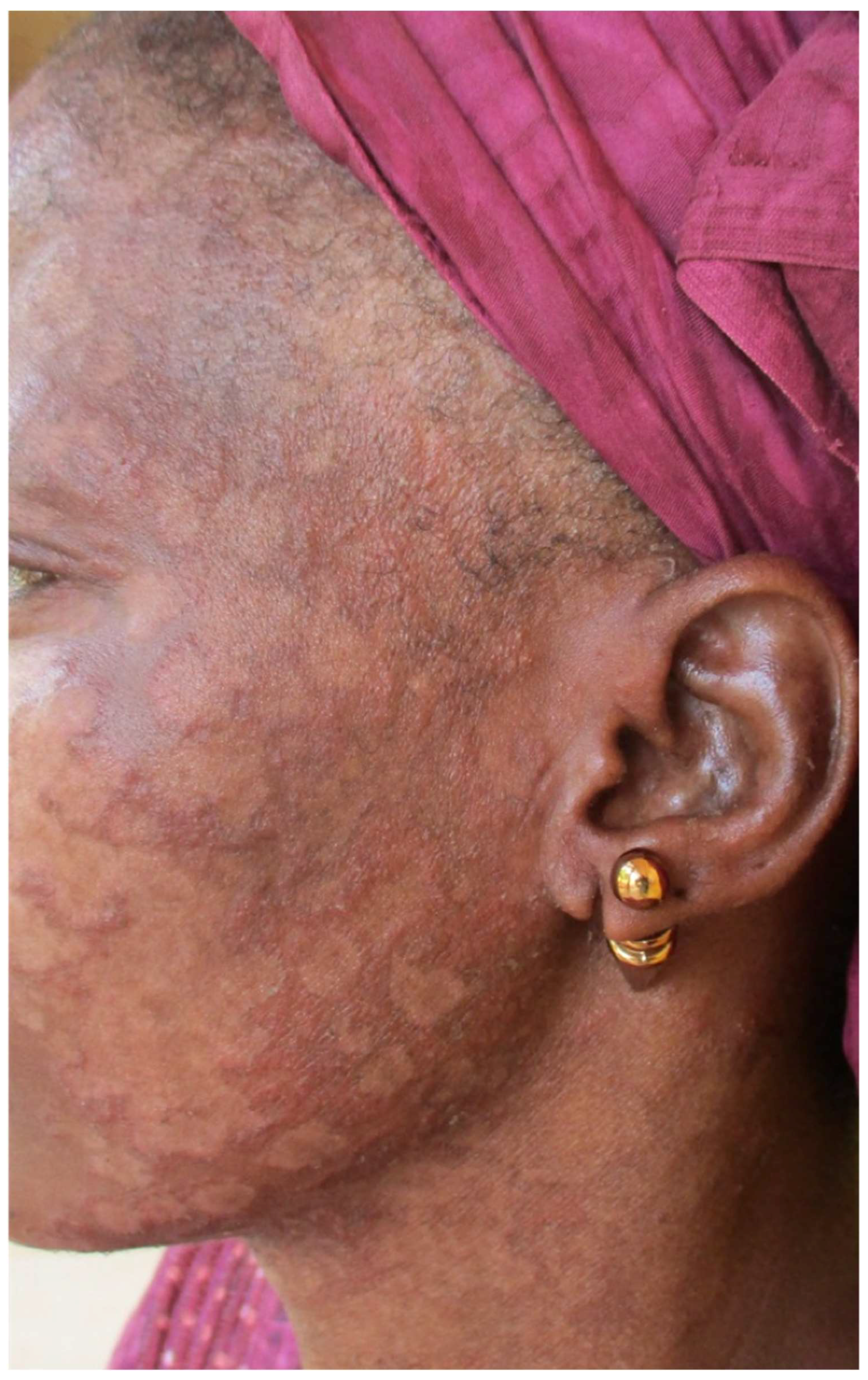 Tropicalmed 03 00088 g004