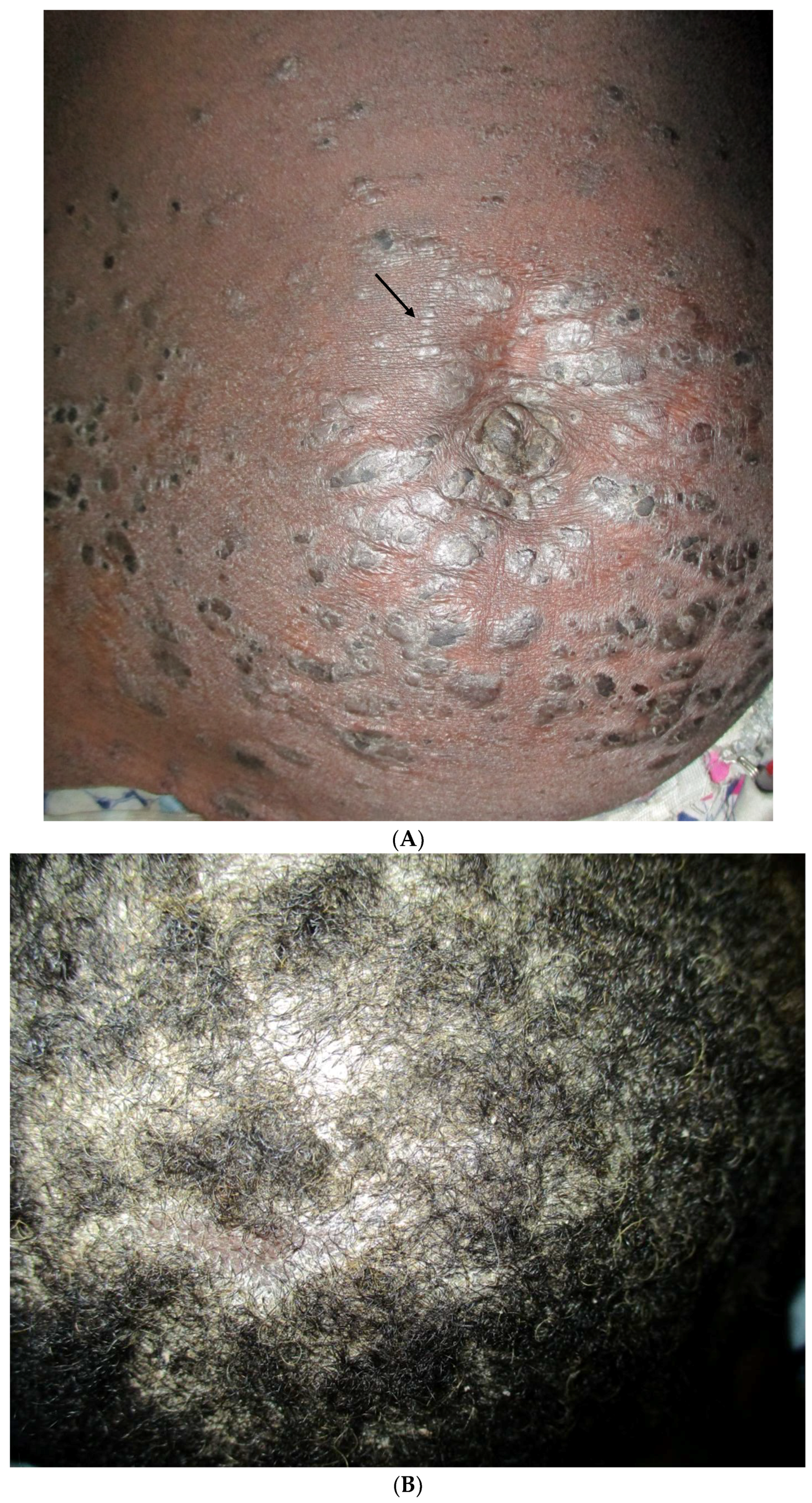 Tropicalmed 03 00088 g005