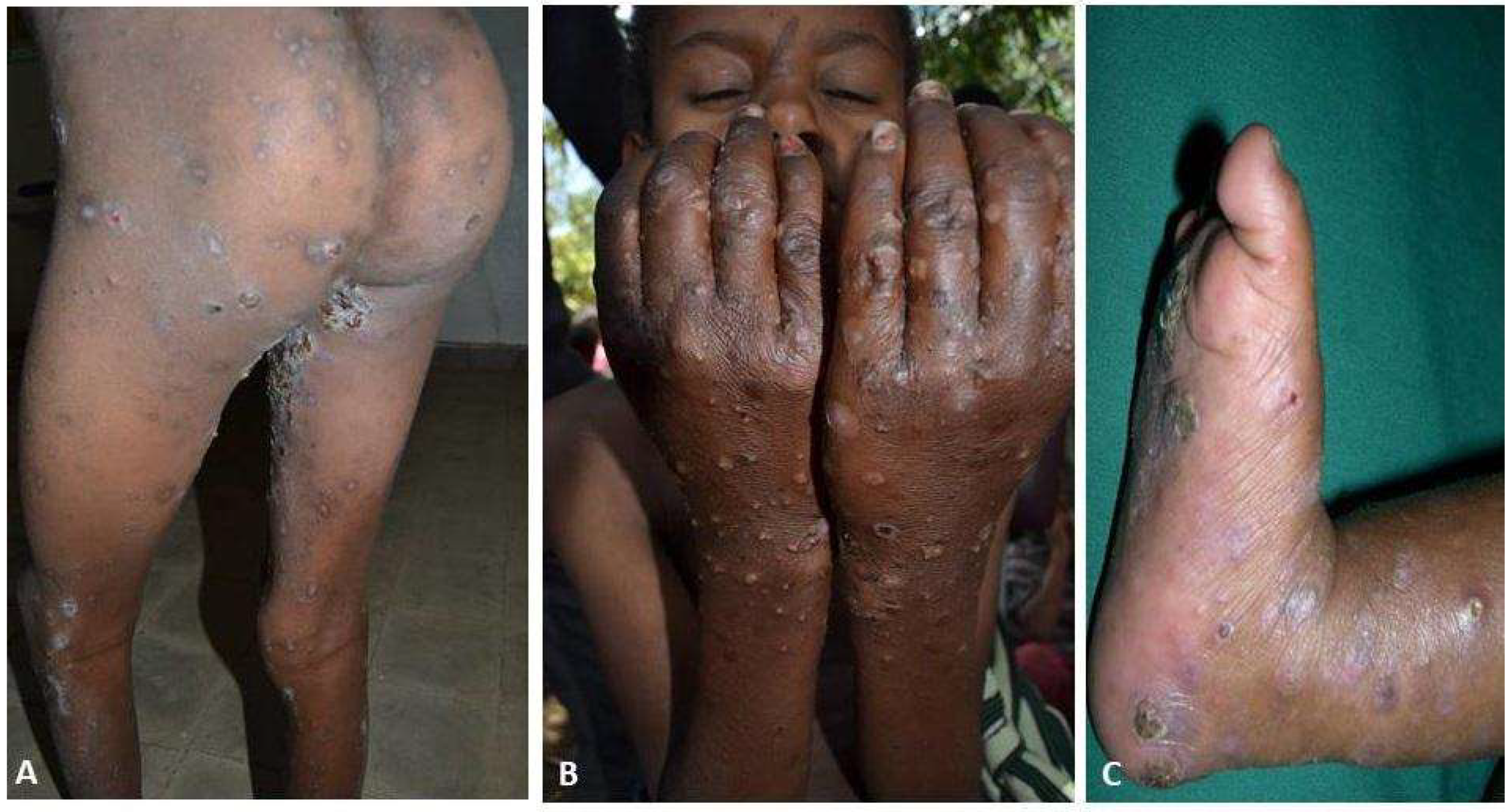 Tropicalmed 03 00114 g003