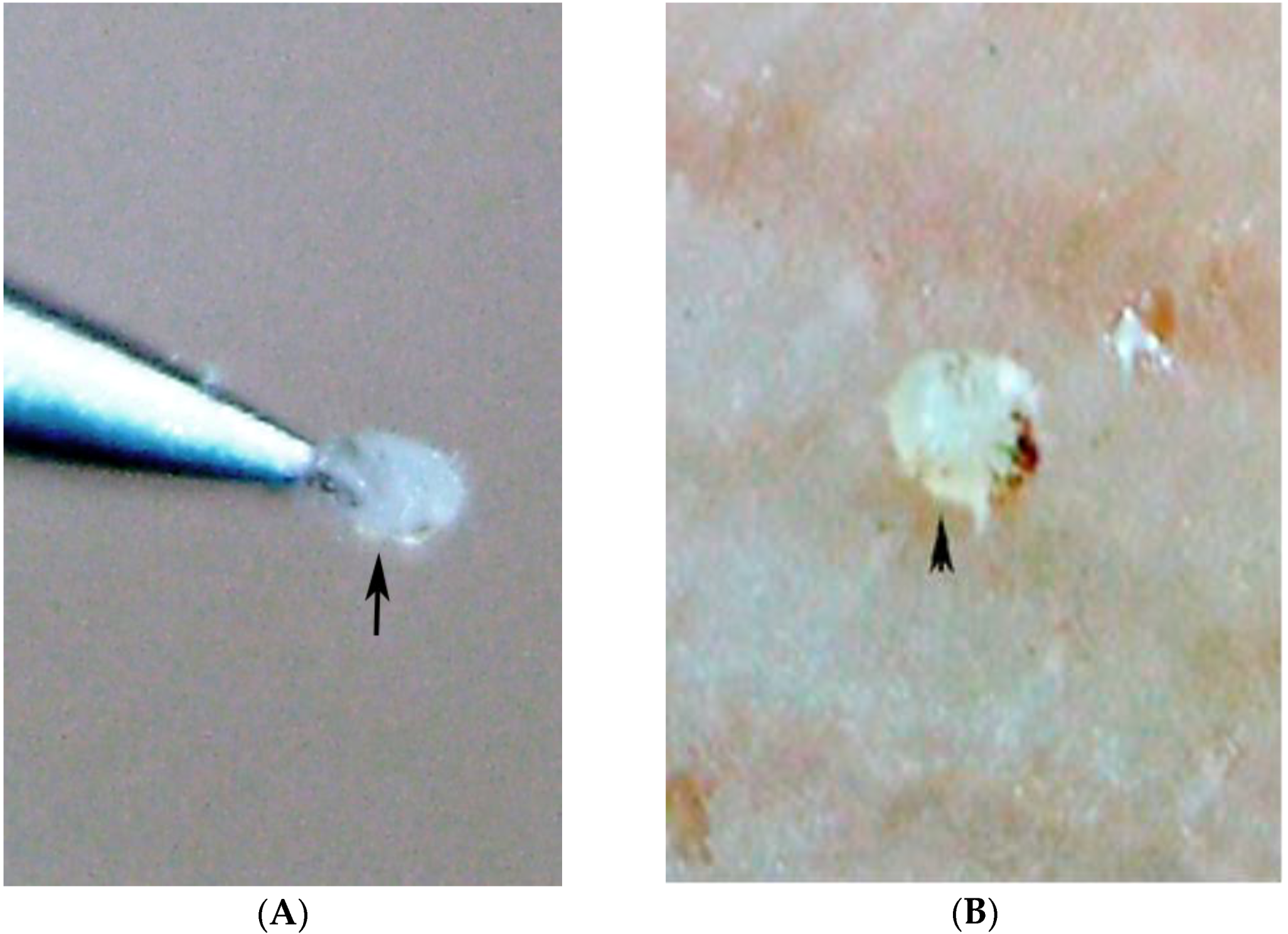 Tropicalmed 03 00116 g005
