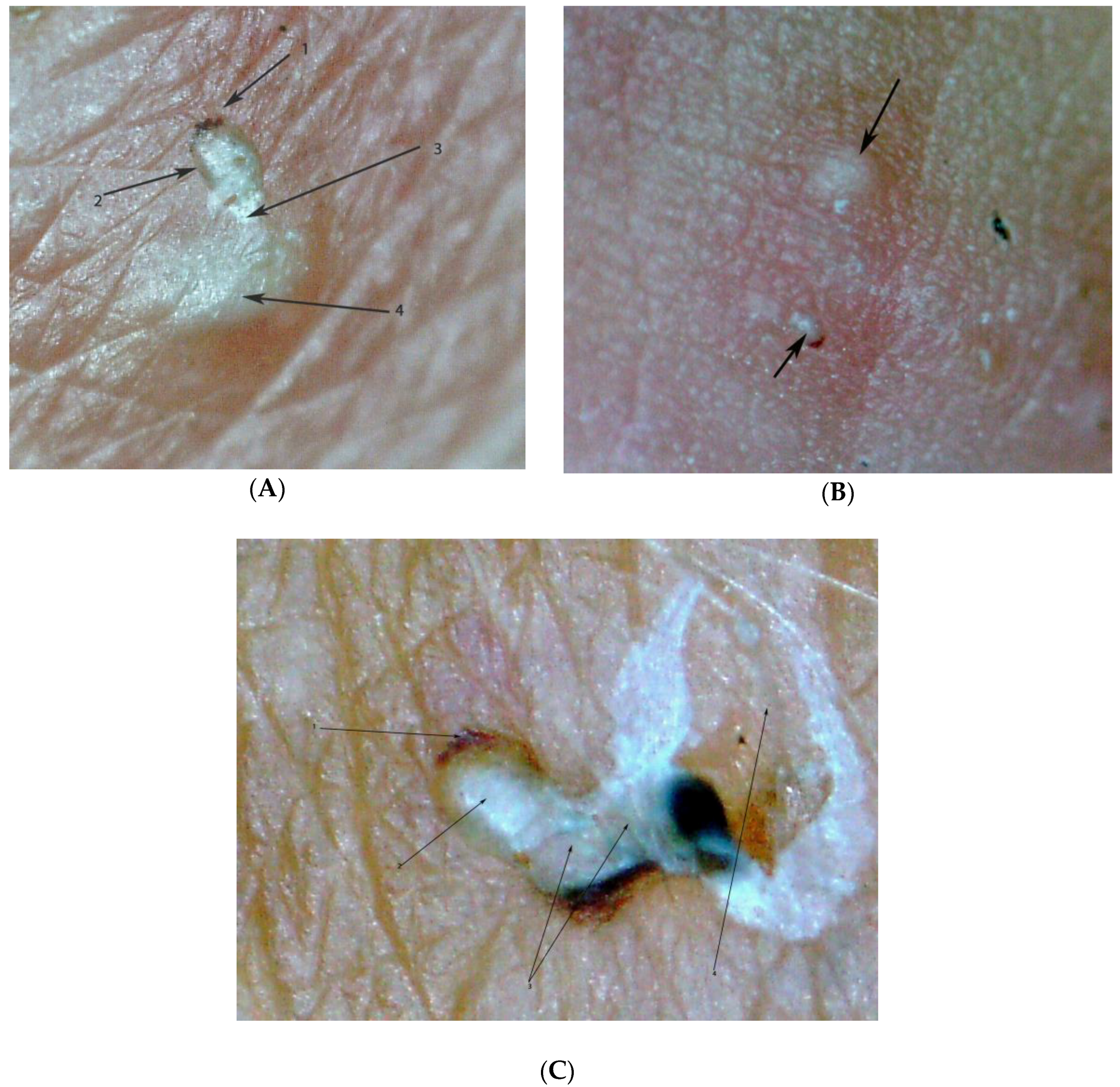 Tropicalmed 03 00116 g006