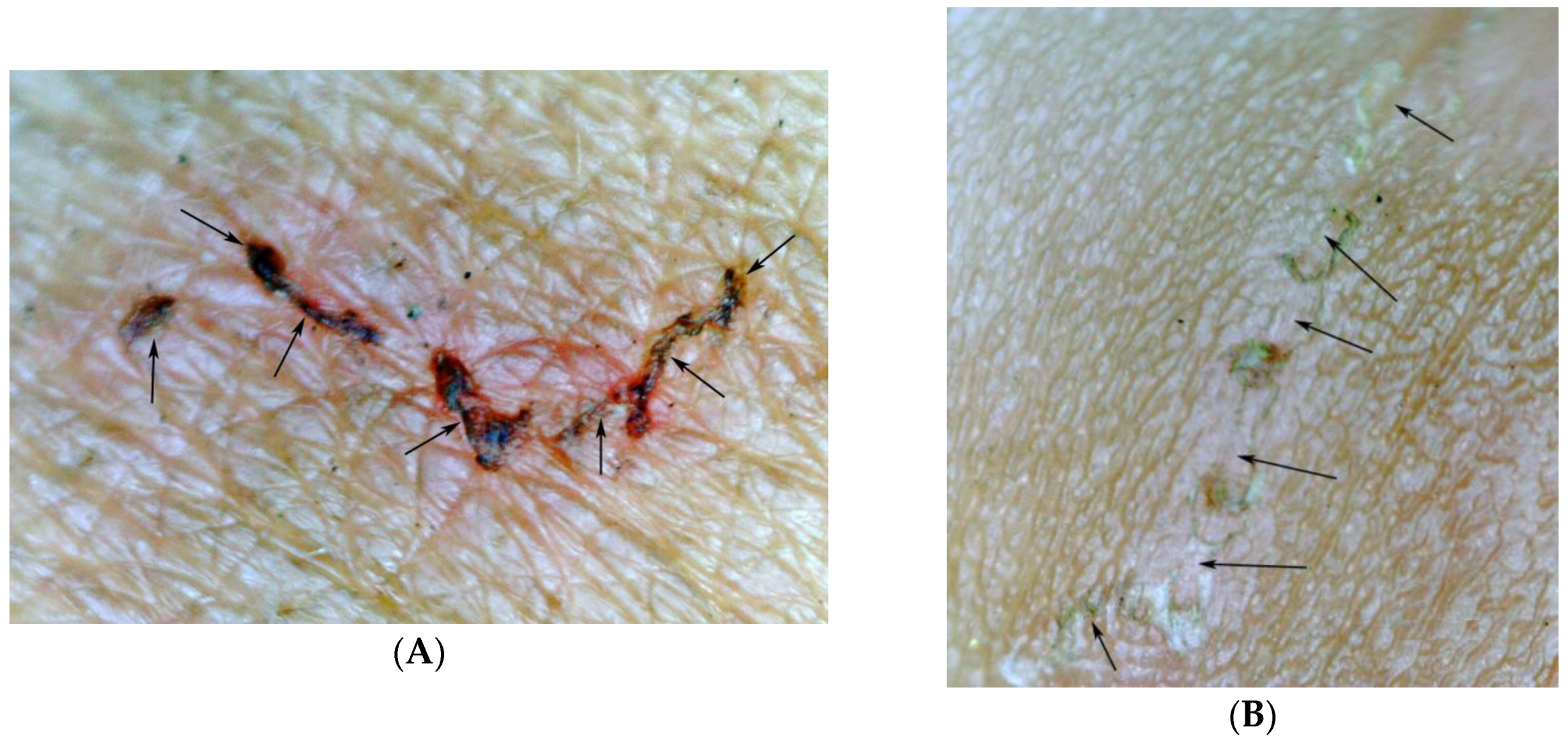 Tropicalmed 03 00116 g008