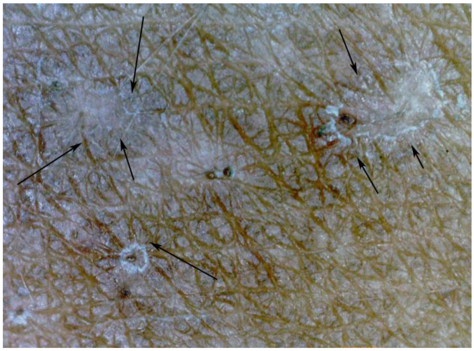 Tropicalmed 03 00116 g009