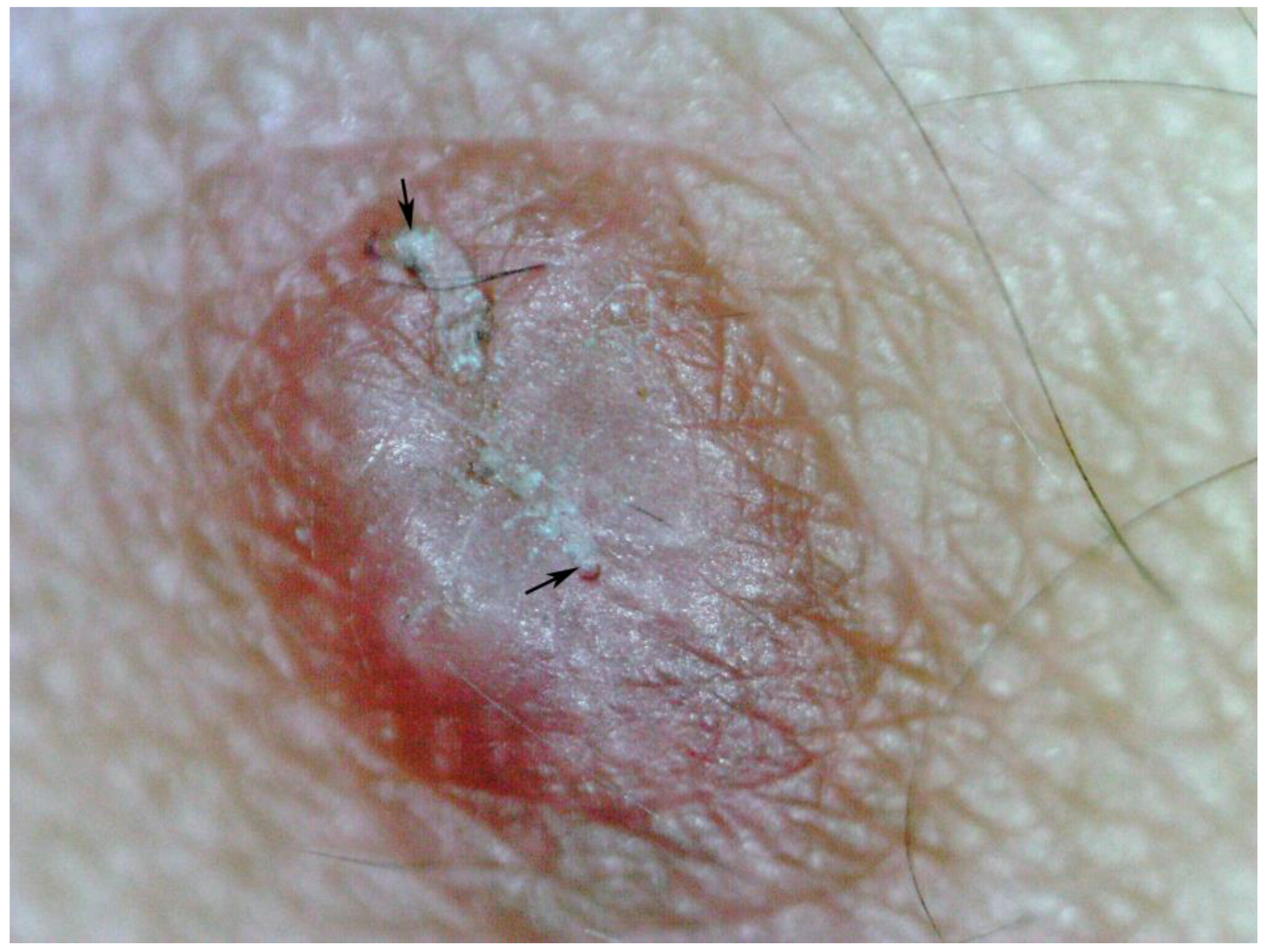 Tropicalmed 03 00116 g011