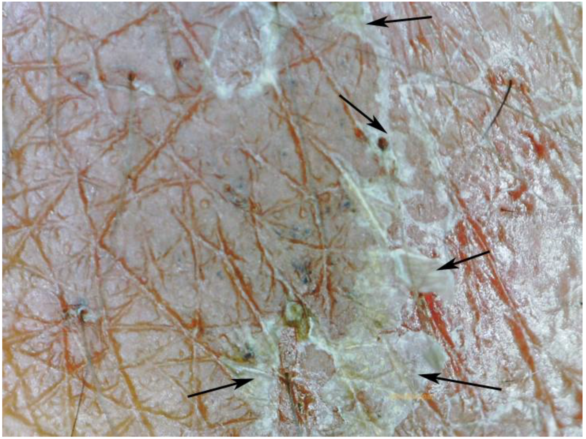 Tropicalmed 03 00116 g012