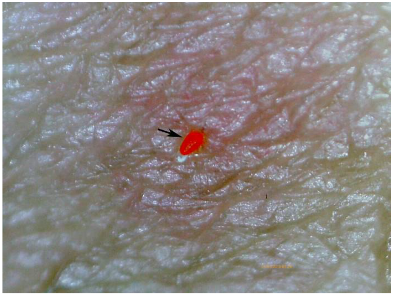 Tropicalmed 03 00116 g013