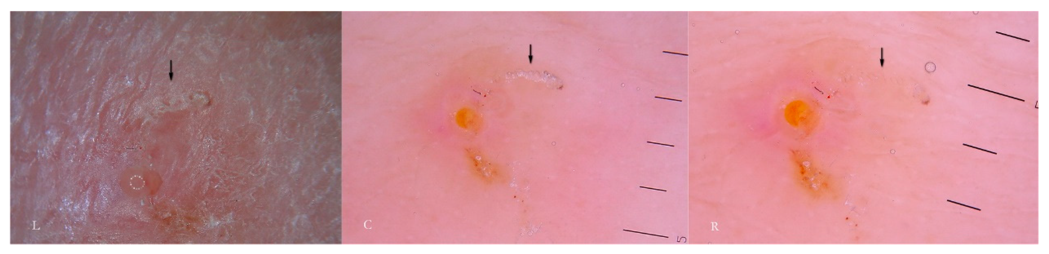 Tropicalmed 04 00048 g003