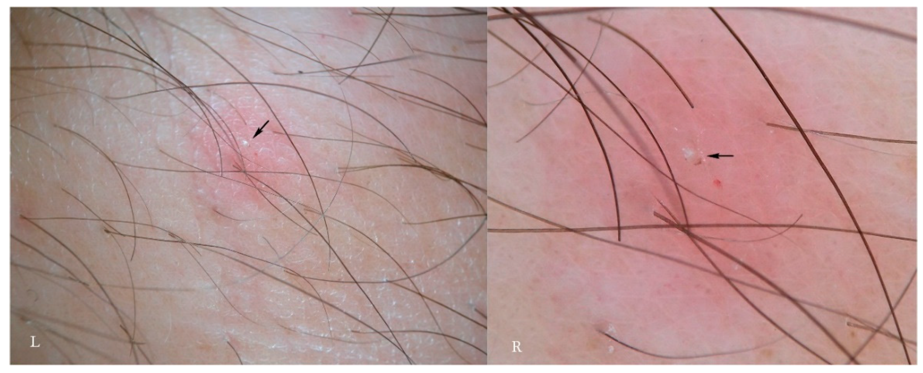 Tropicalmed 04 00048 g007