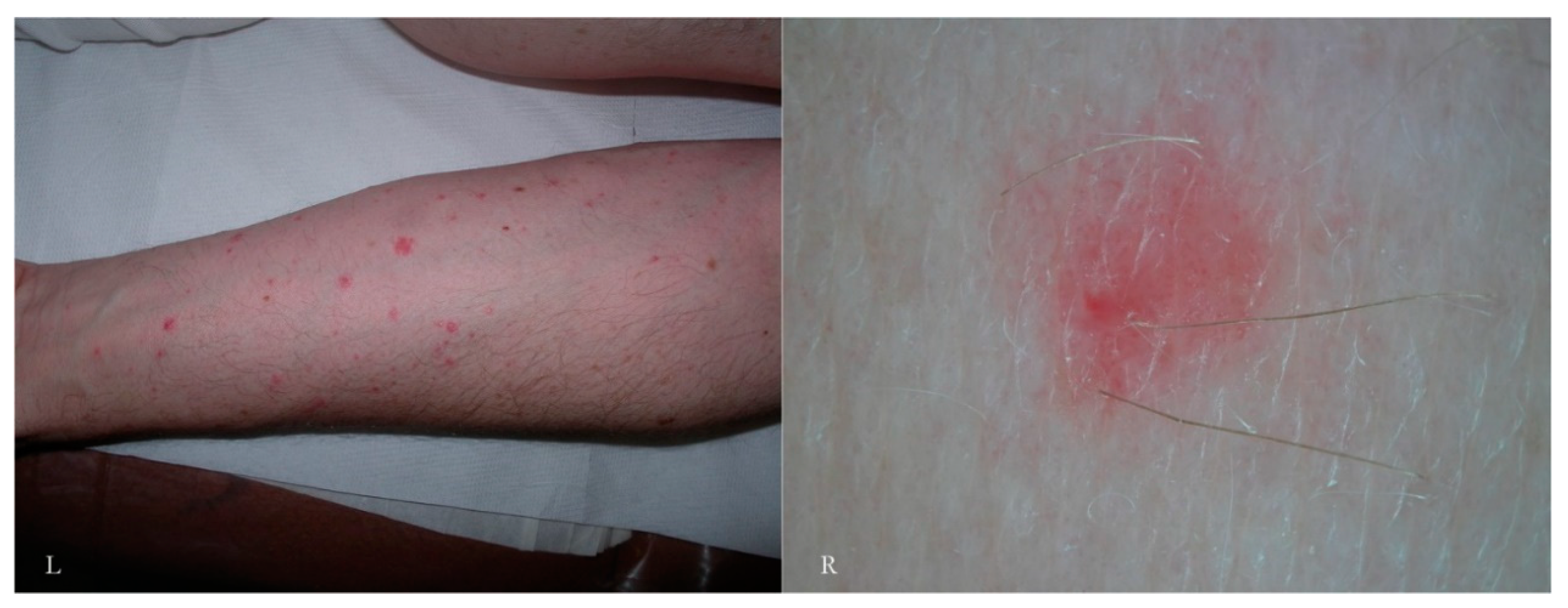 Tropicalmed 04 00048 g008