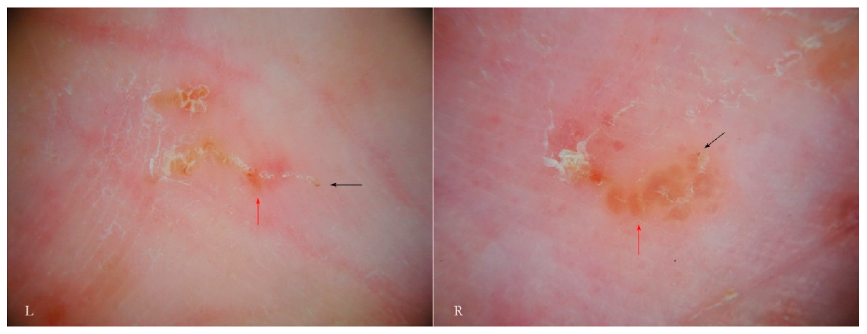 Tropicalmed 04 00048 g009