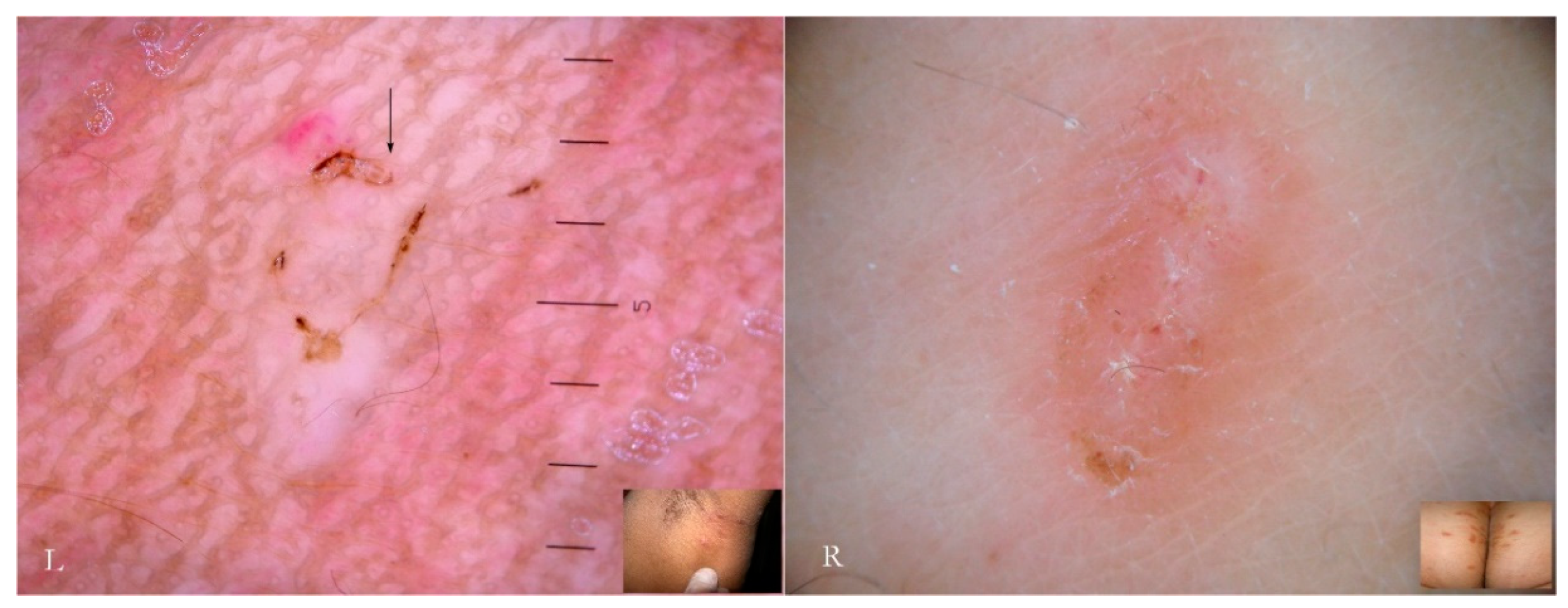 Tropicalmed 04 00048 g010