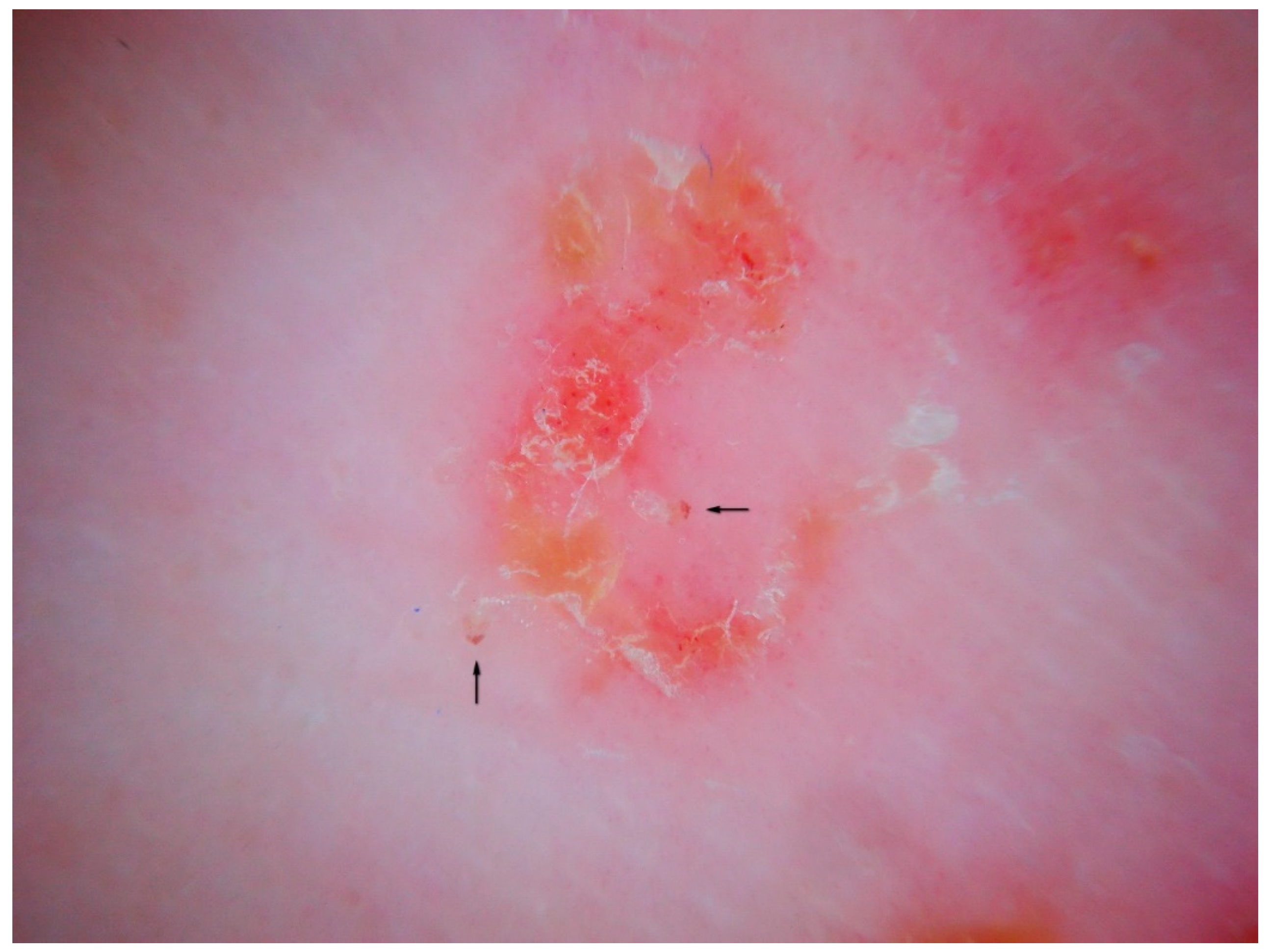 Tropicalmed 04 00048 g011