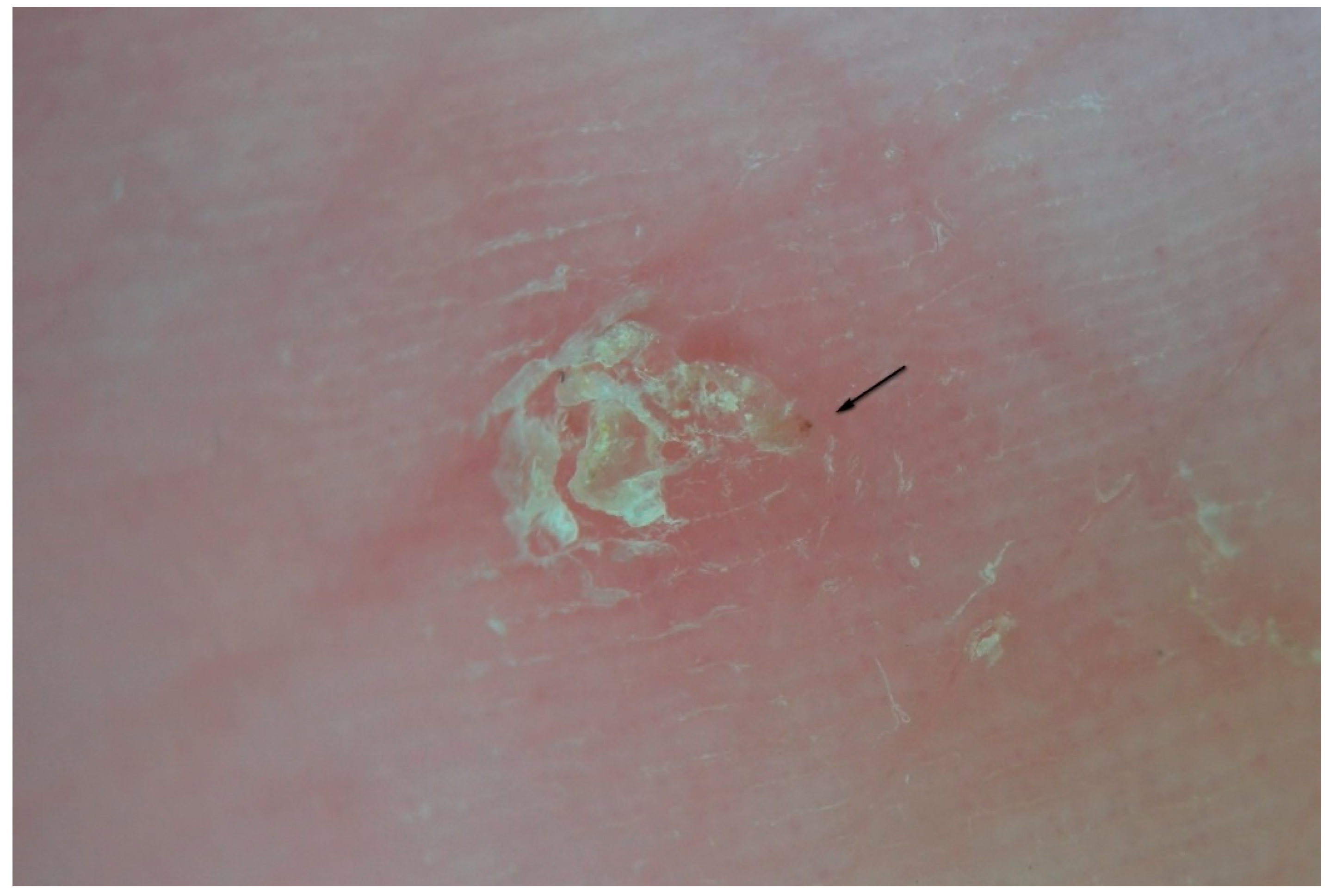 Tropicalmed 04 00048 g012