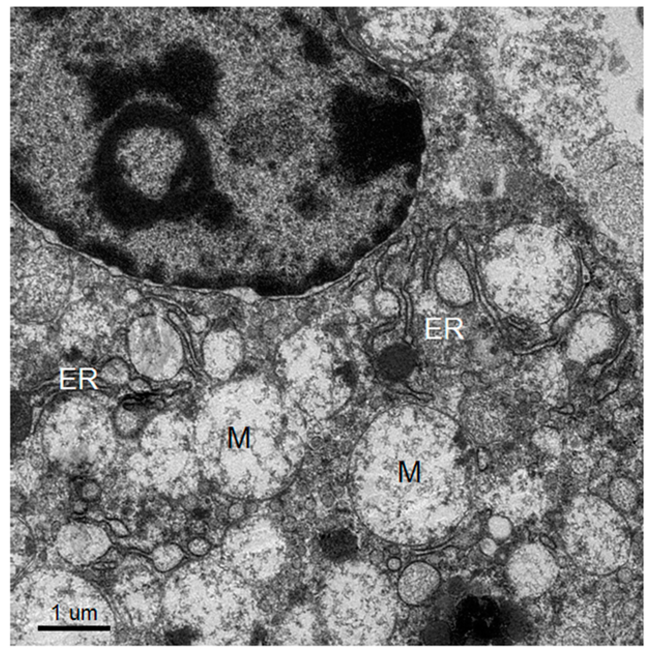 Tropicalmed 04 00063 g004