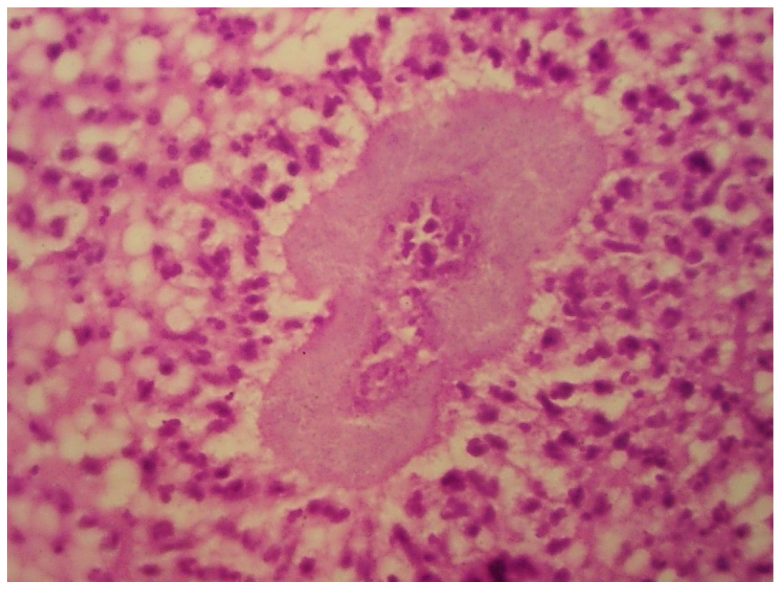 Tropicalmed 04 00081 g002