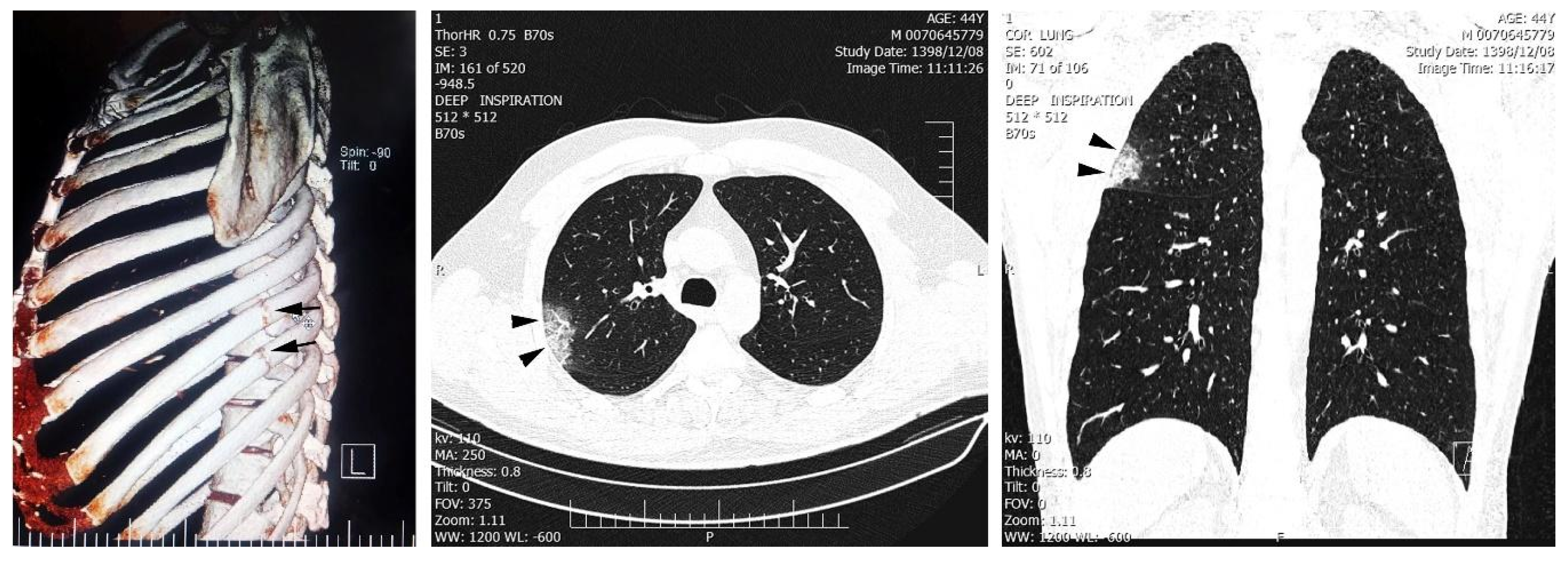 Tropicalmed 05 00056 g001