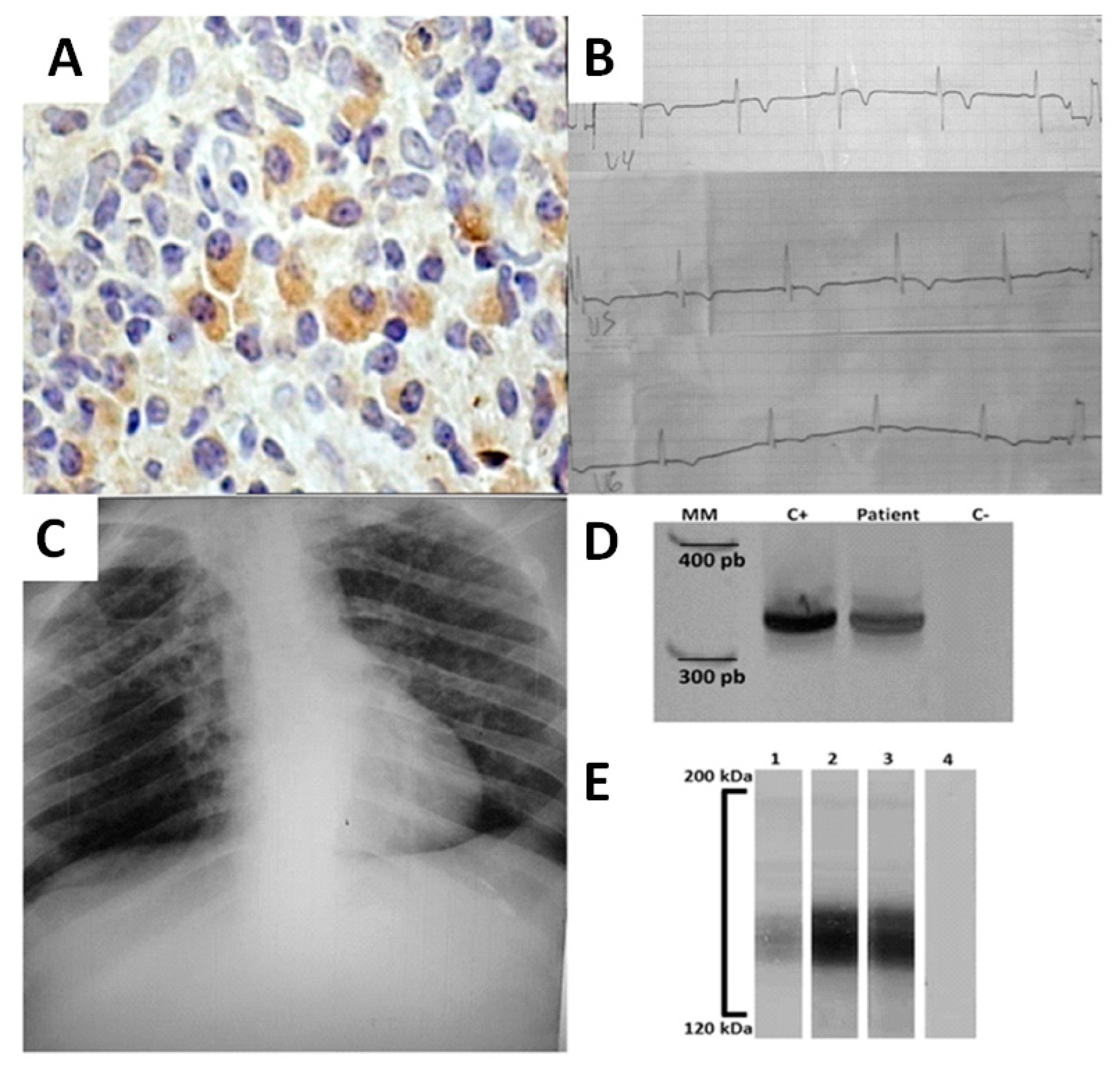 Tropicalmed 05 00069 g001 Tropicalmed 05 00069 g001