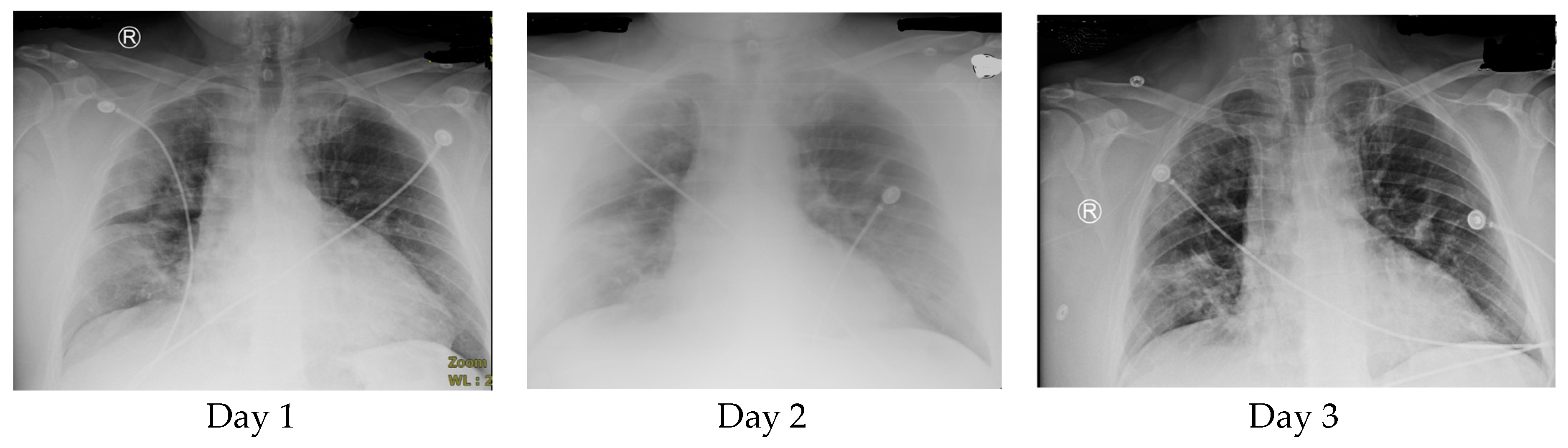Tropicalmed 05 00112 g001