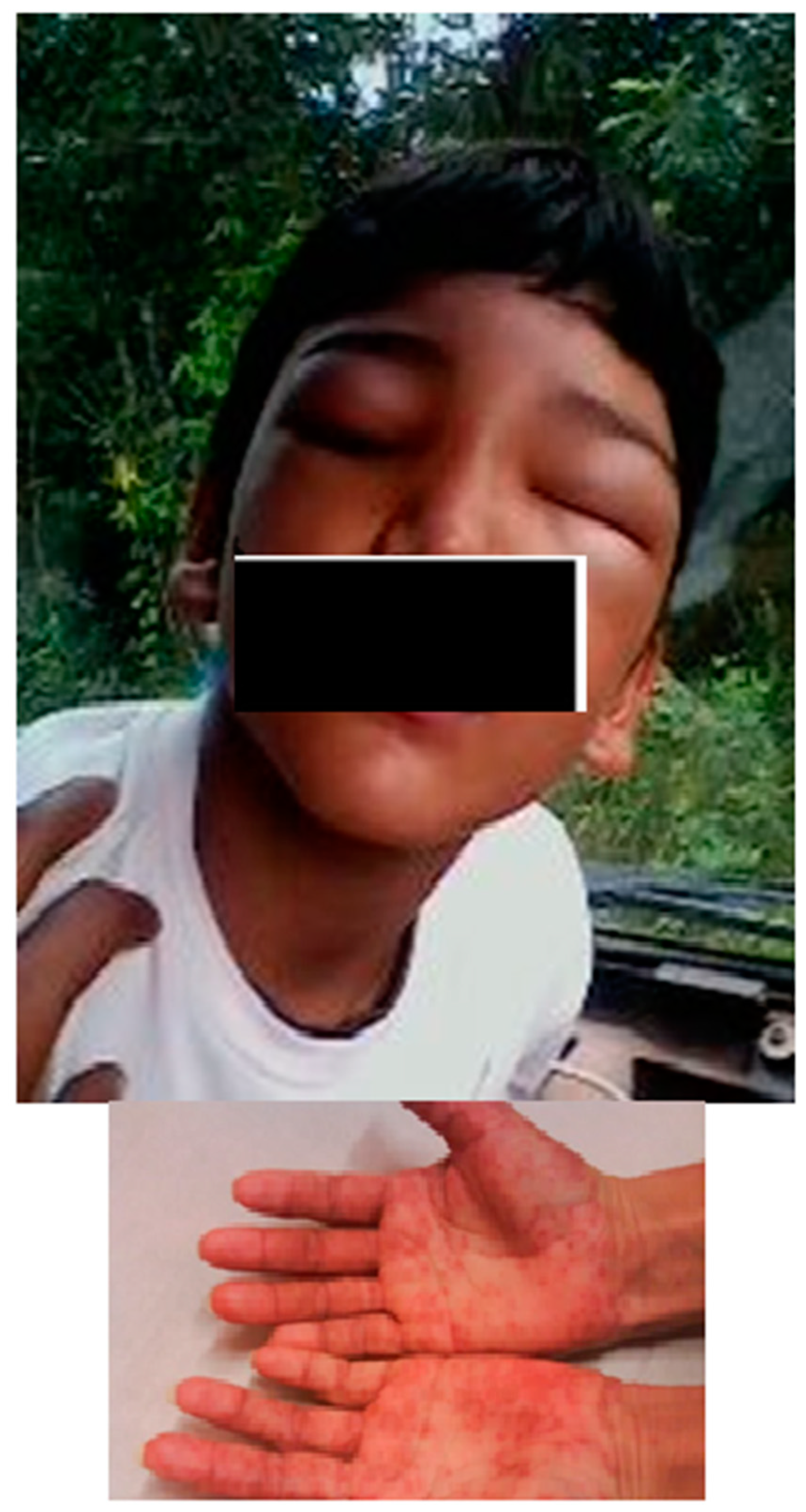 Tropicalmed 05 00139 g004 Tropicalmed 05 00139 g004