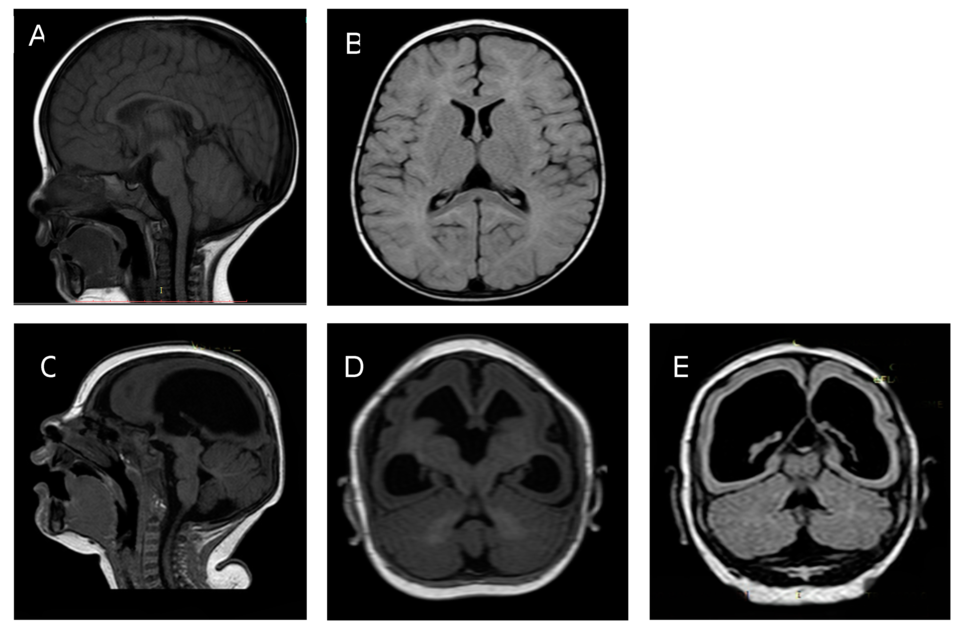 Tropicalmed 05 00188 g001