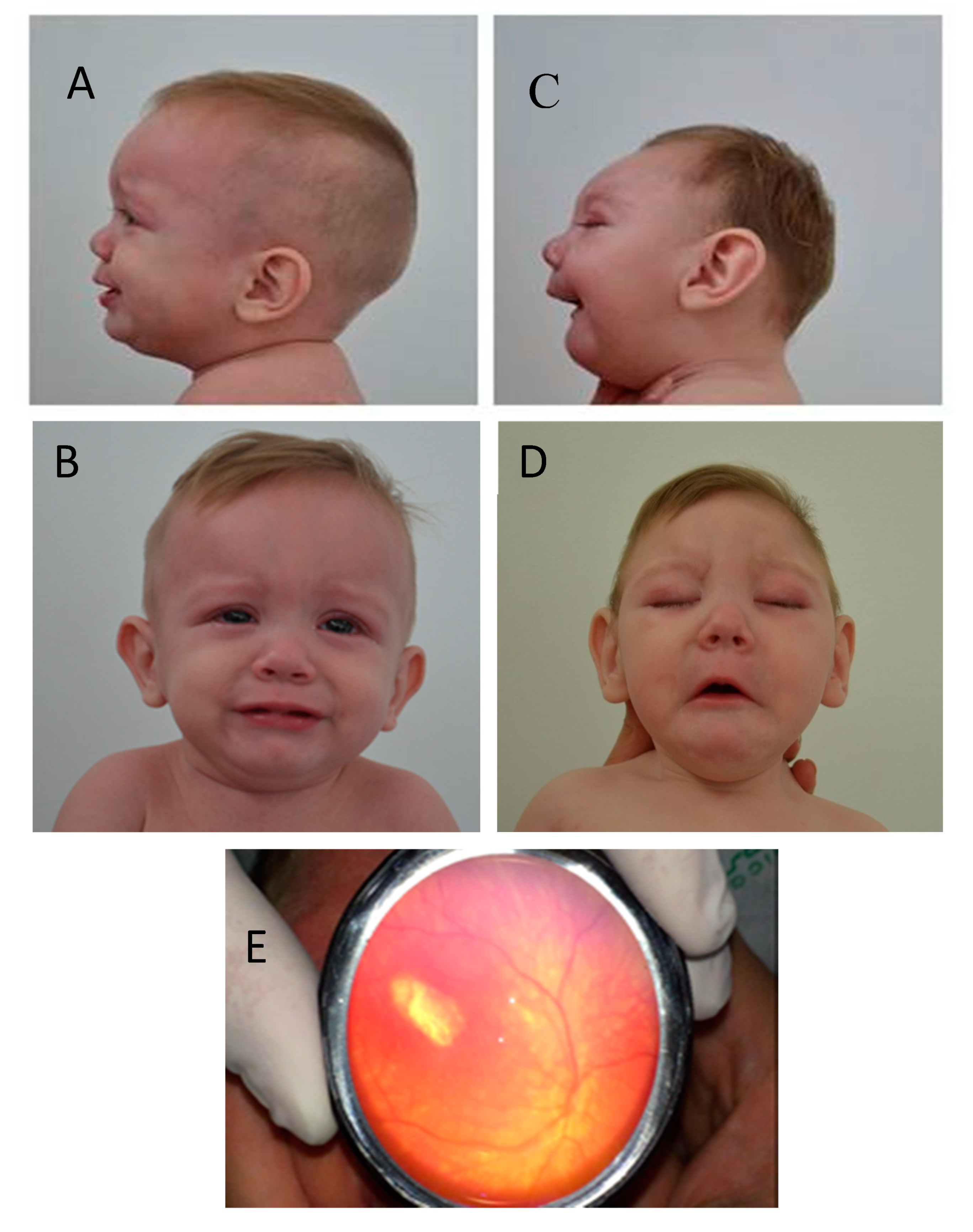 Tropicalmed 05 00188 g003