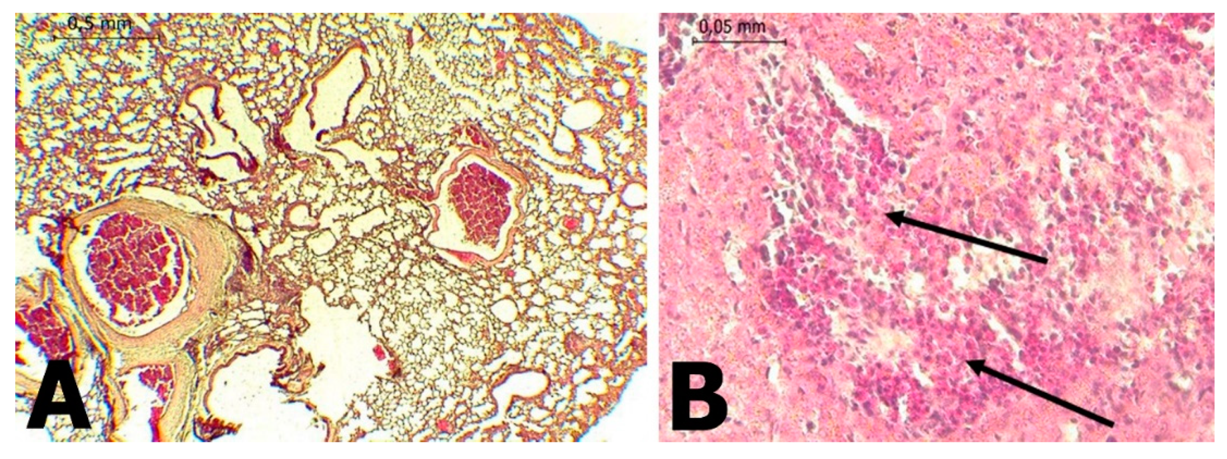 Tropicalmed 06 00035 g004