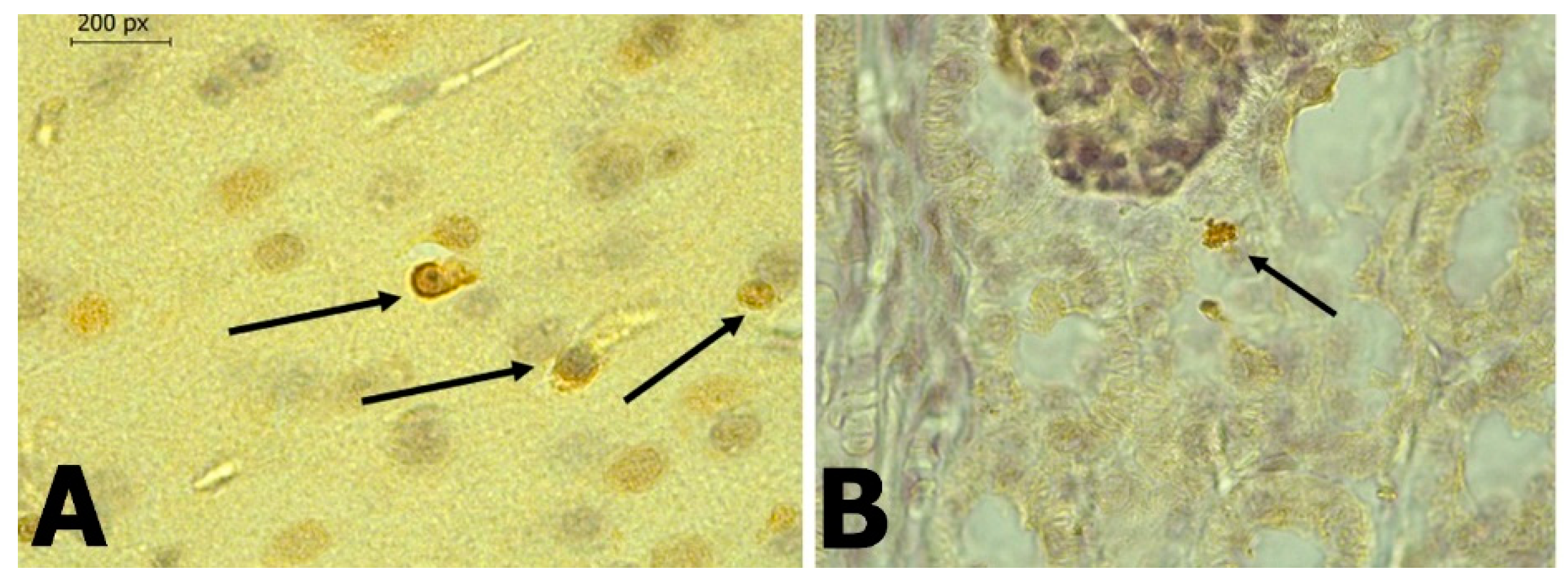 Tropicalmed 06 00035 g006