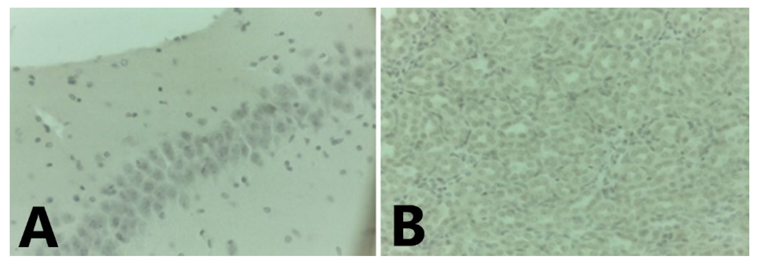 Tropicalmed 06 00035 g007