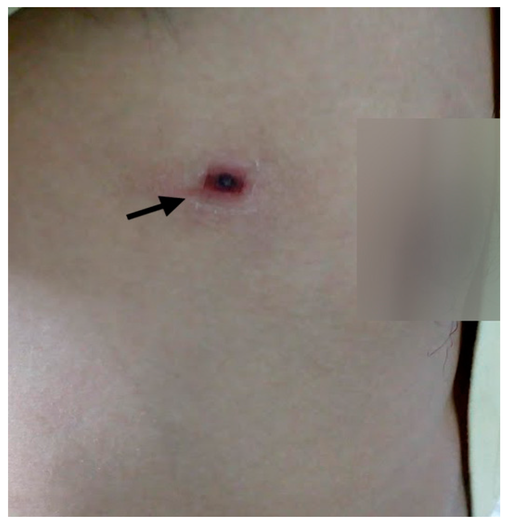 Tropicalmed 06 00078 g004