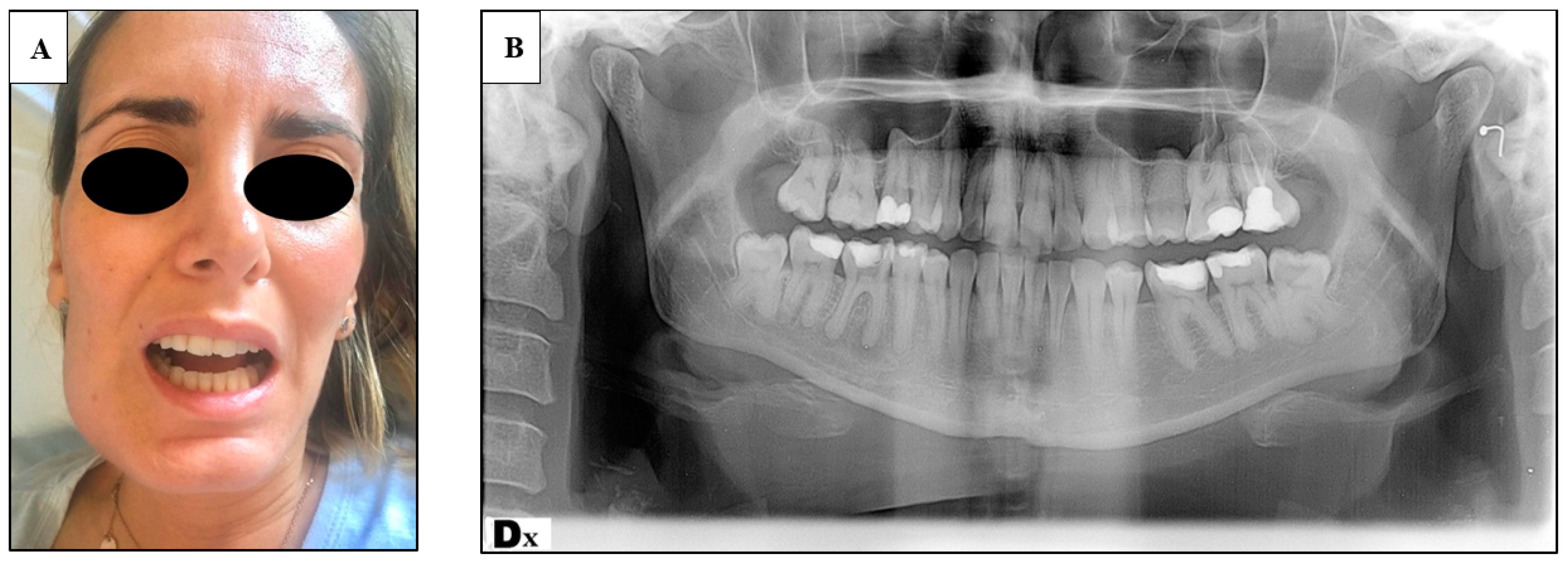 Tropicalmed 06 00106 g001 Tropicalmed 06 00106 g001