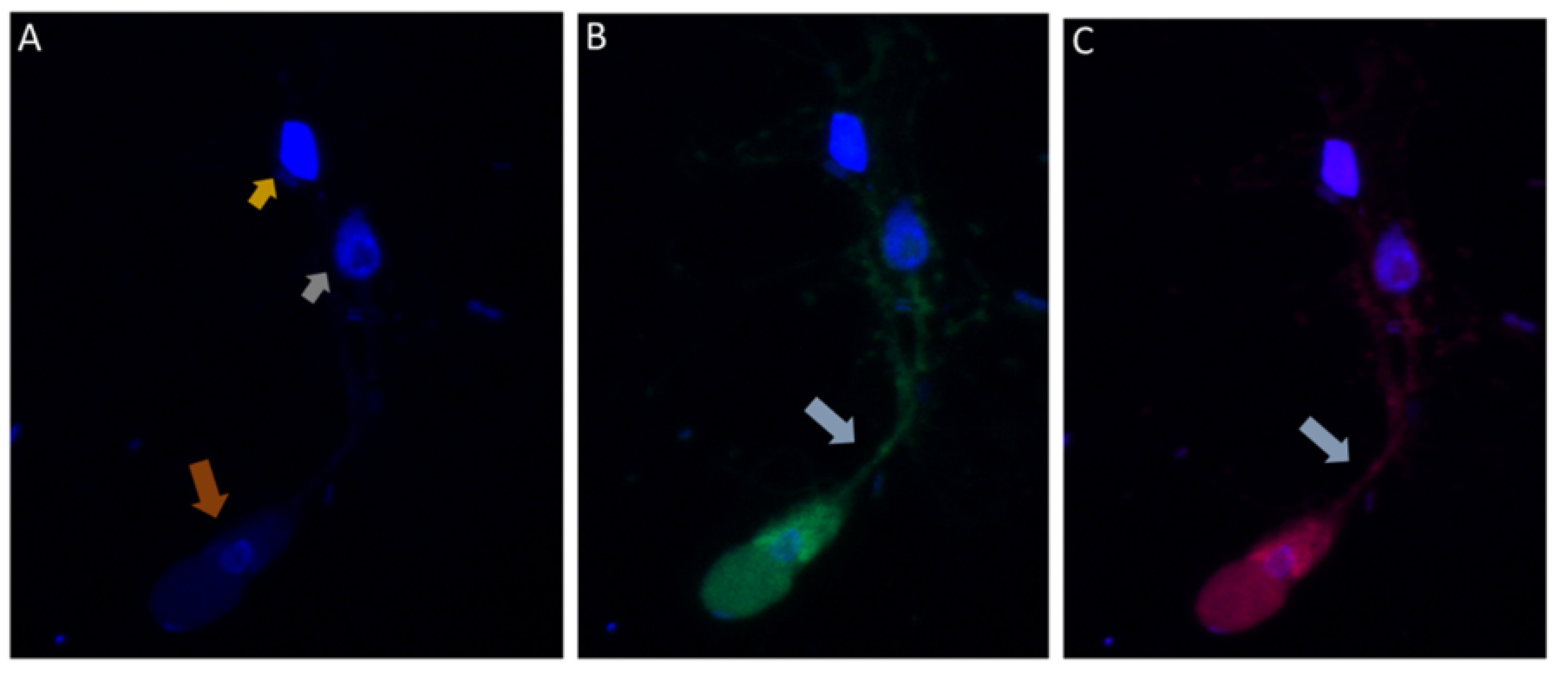 Tropicalmed 06 00127 g007a