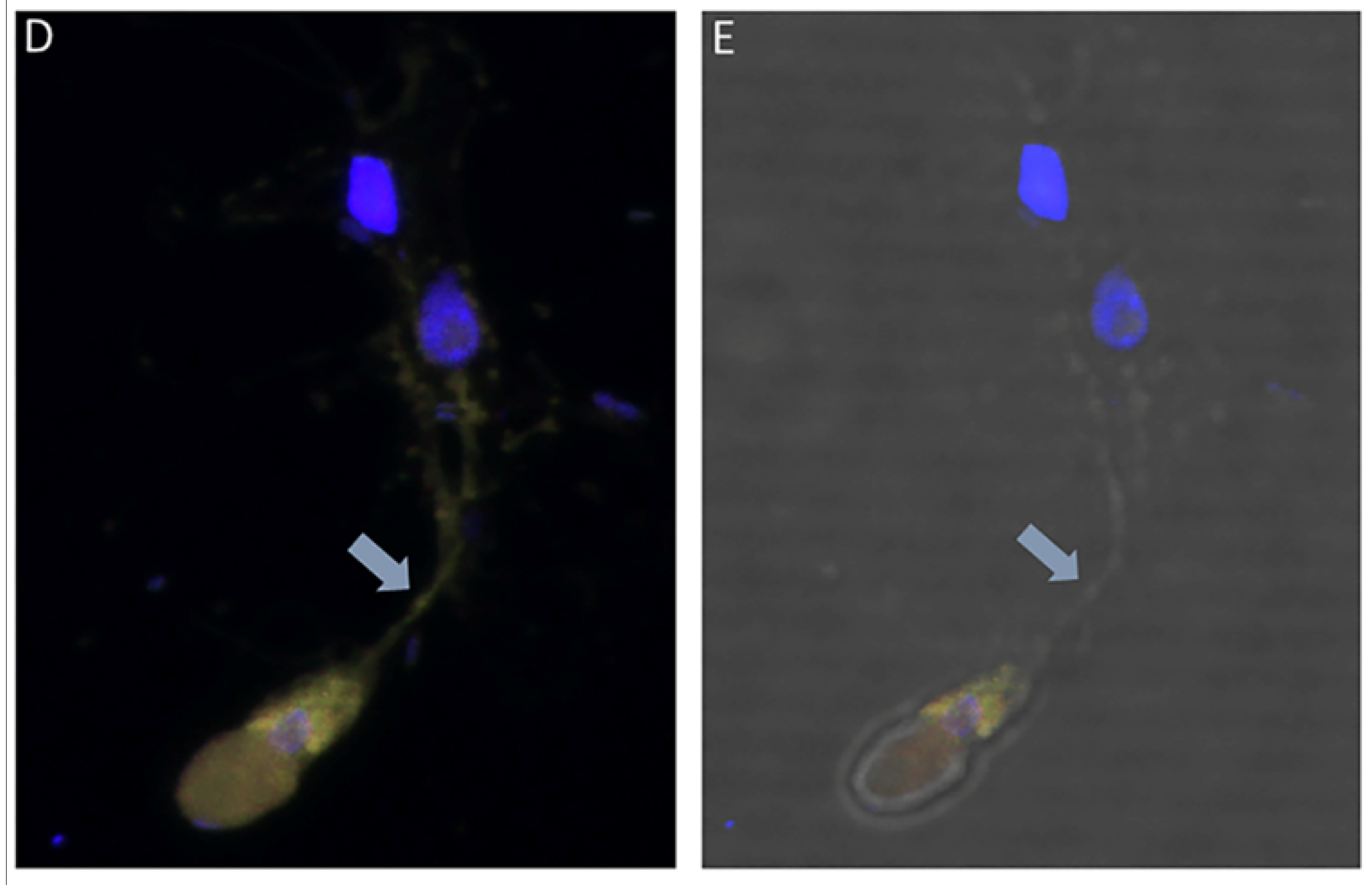 Tropicalmed 06 00127 g007b