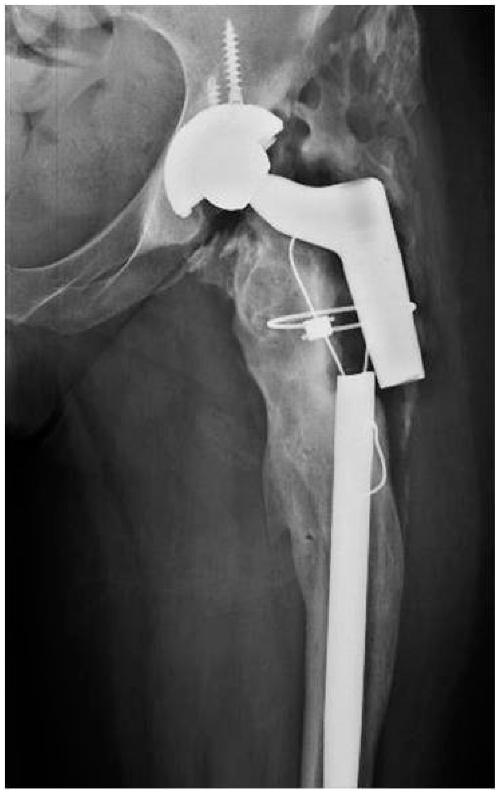 Tropicalmed 07 00005 g003