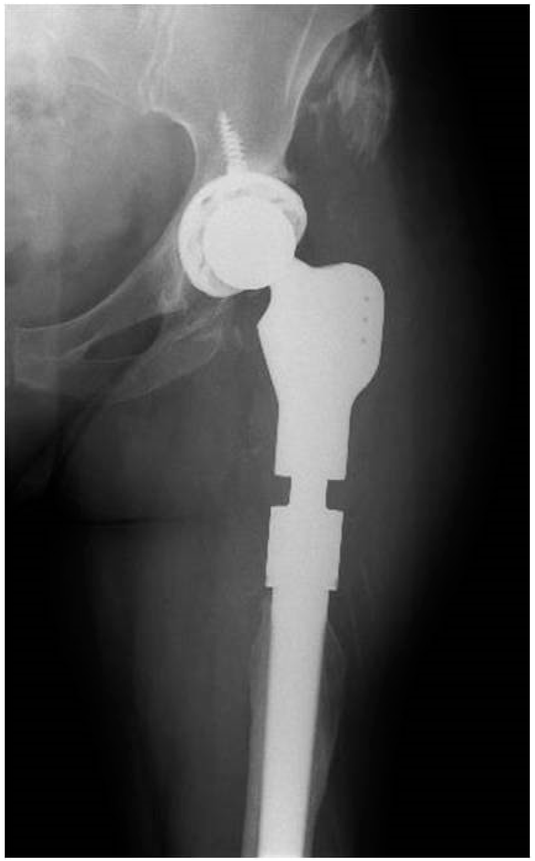 Tropicalmed 07 00005 g004