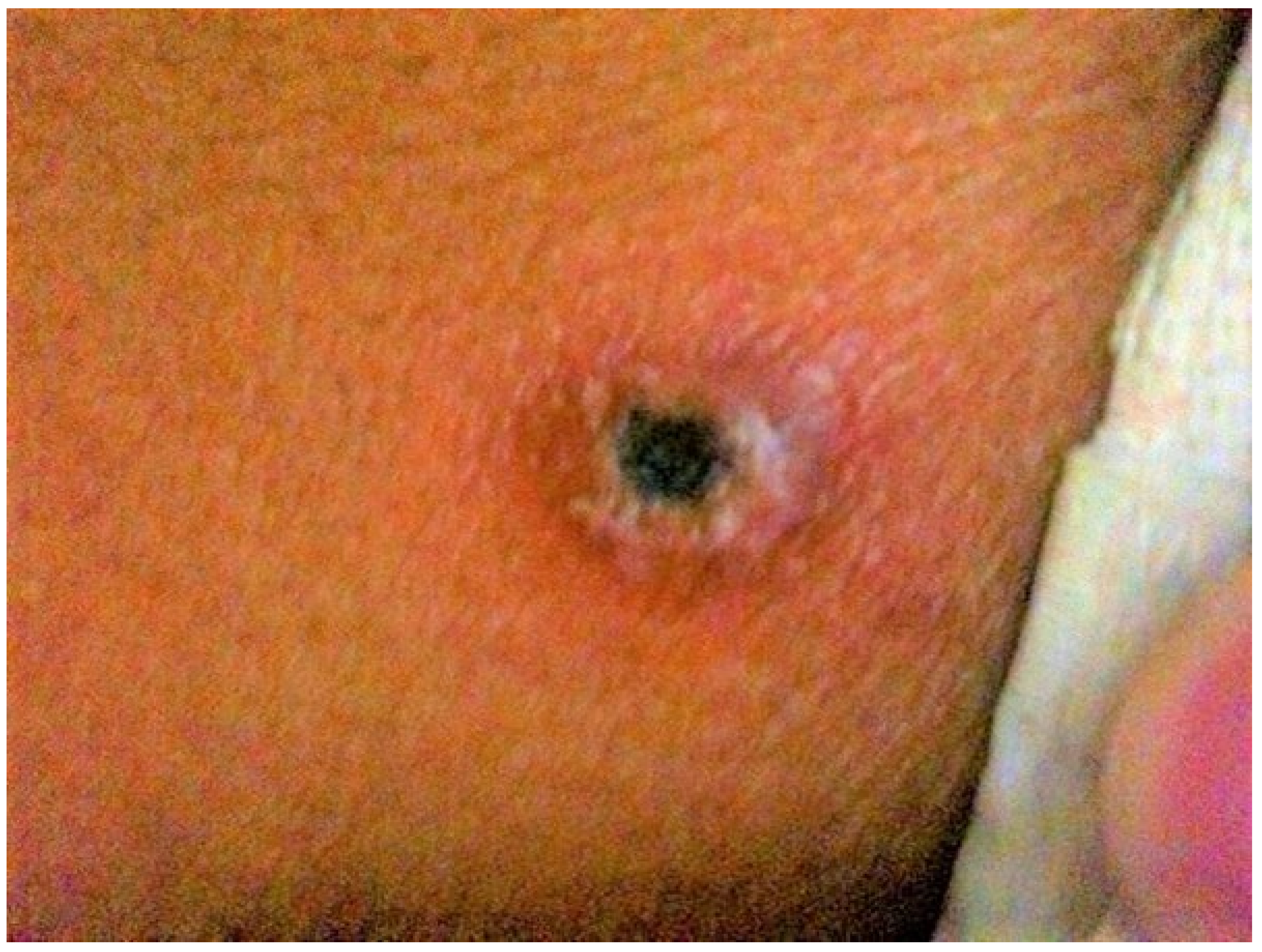 Tropicalmed 07 00018 g001