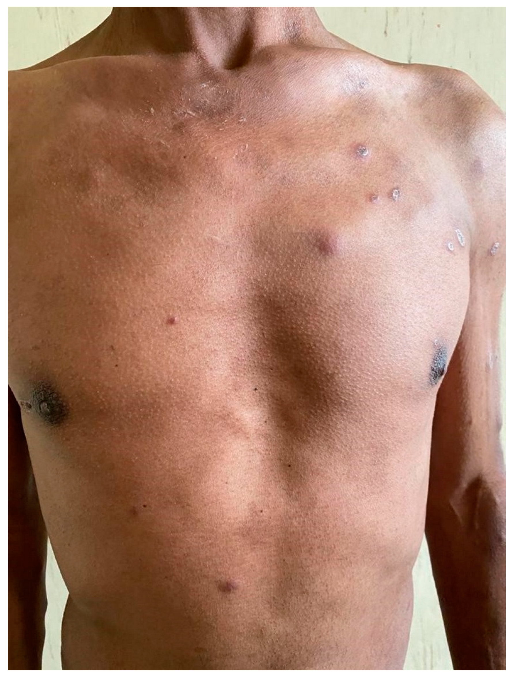 Tropicalmed 07 00024 g001