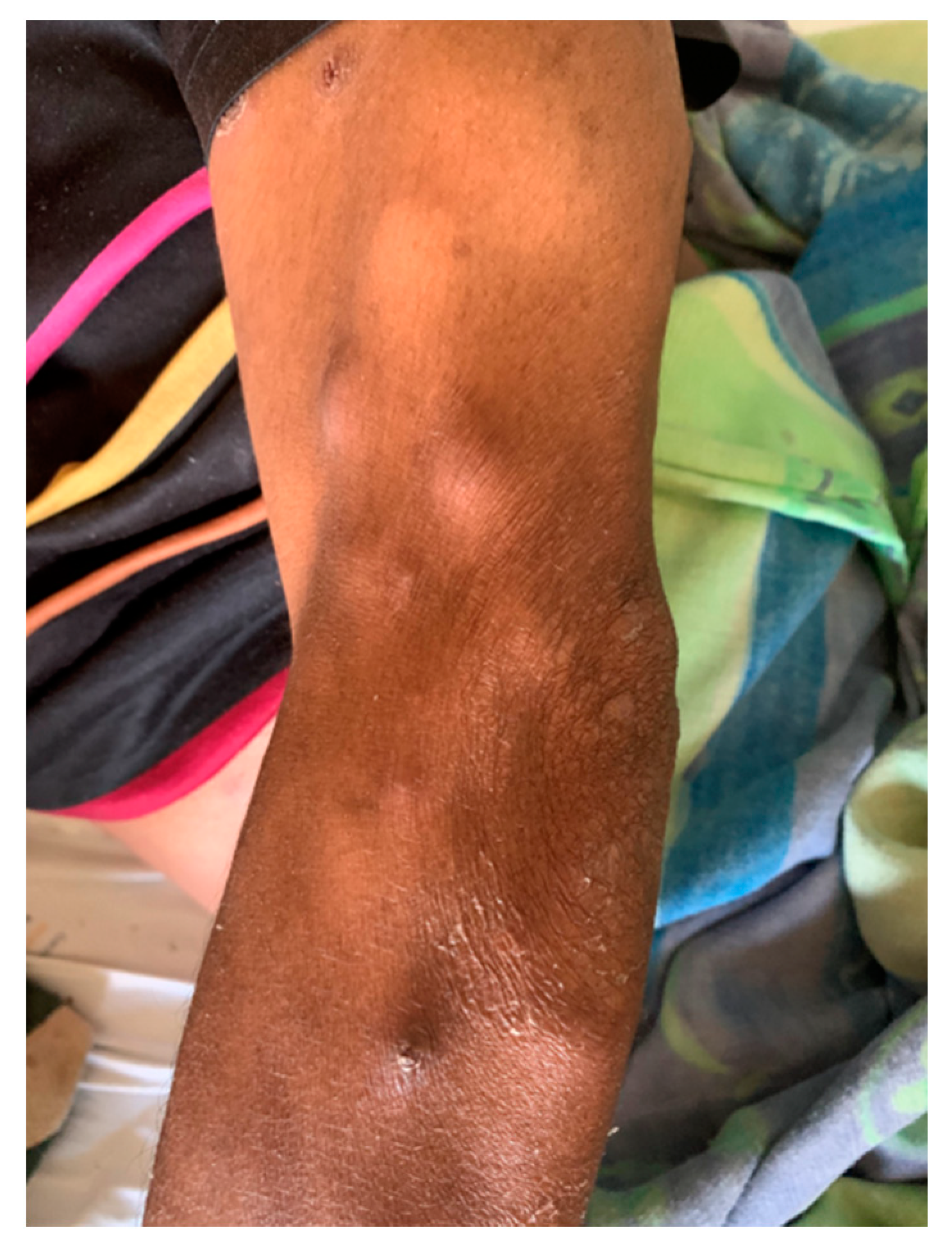 Tropicalmed 07 00024 g002