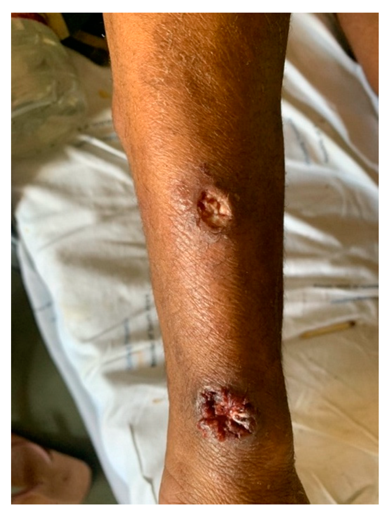 Tropicalmed 07 00024 g003