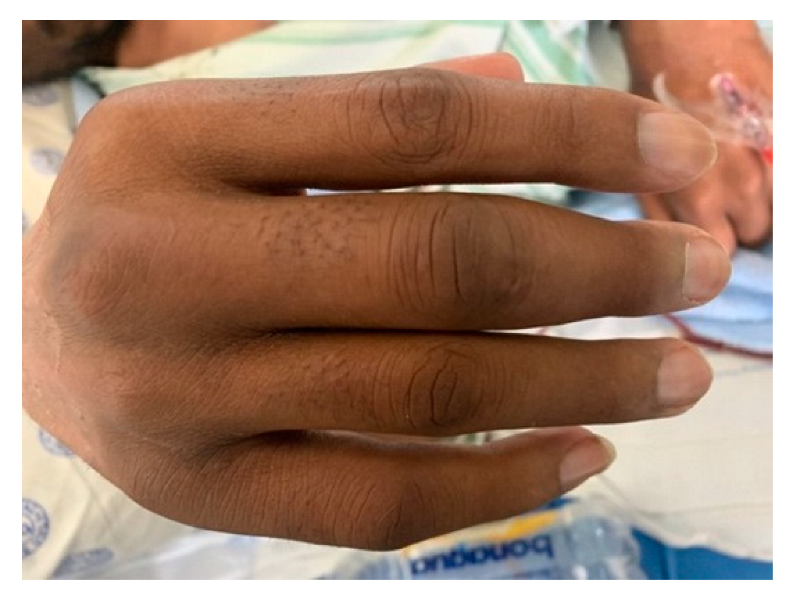 Tropicalmed 07 00024 g004