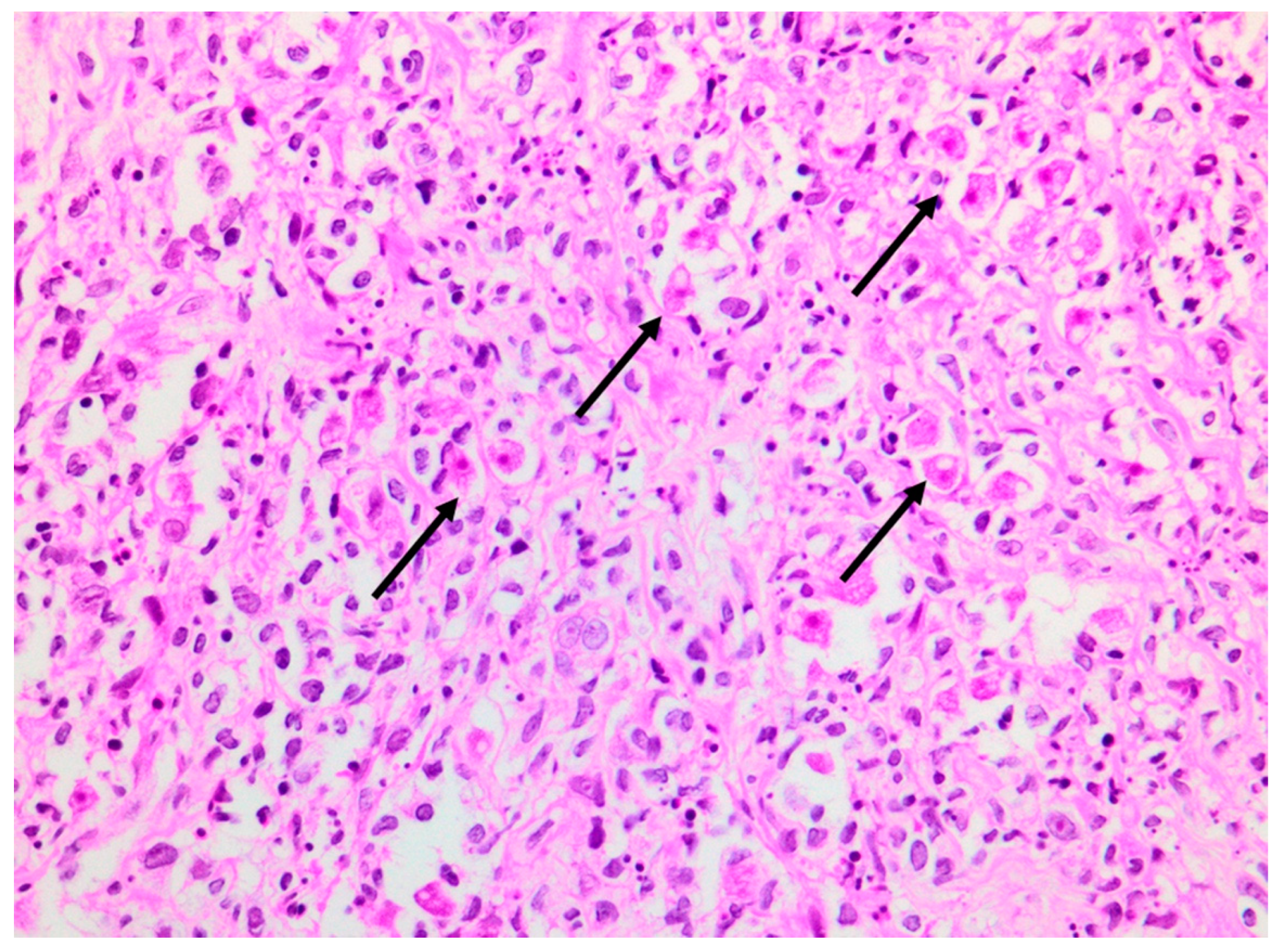 Tropicalmed 07 00024 g005