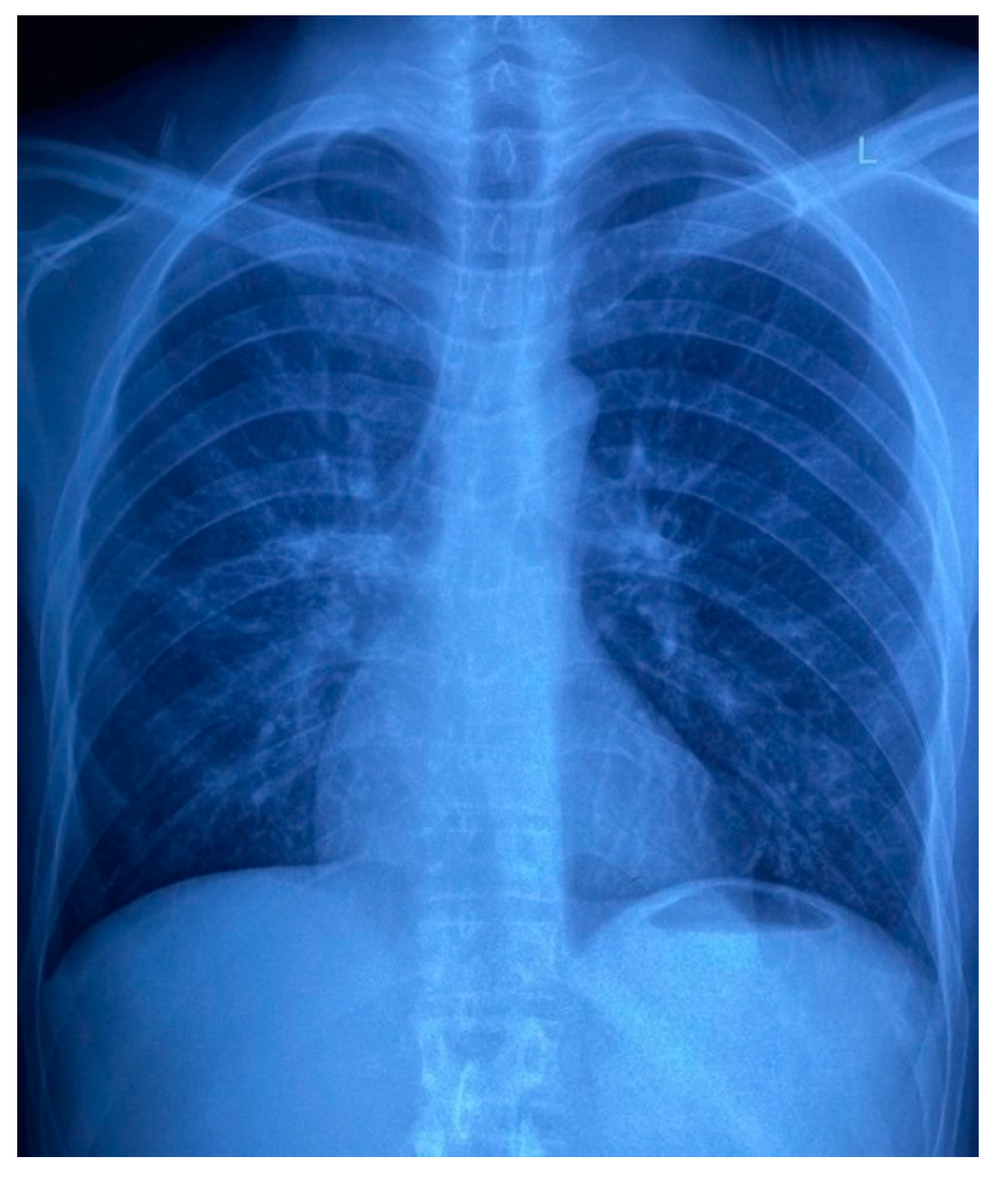 Tropicalmed 07 00024 g007