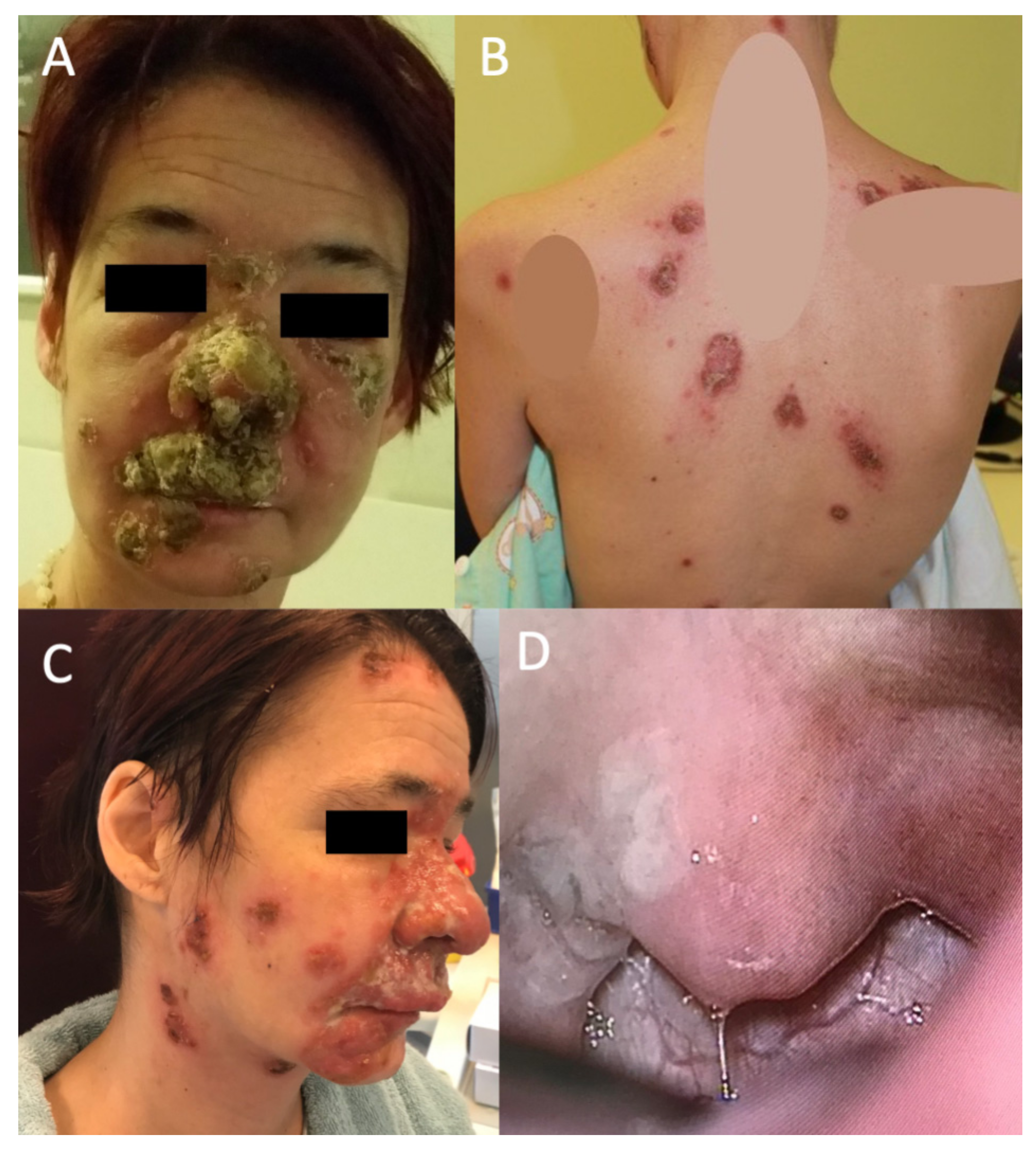 Tropicalmed 07 00047 g001