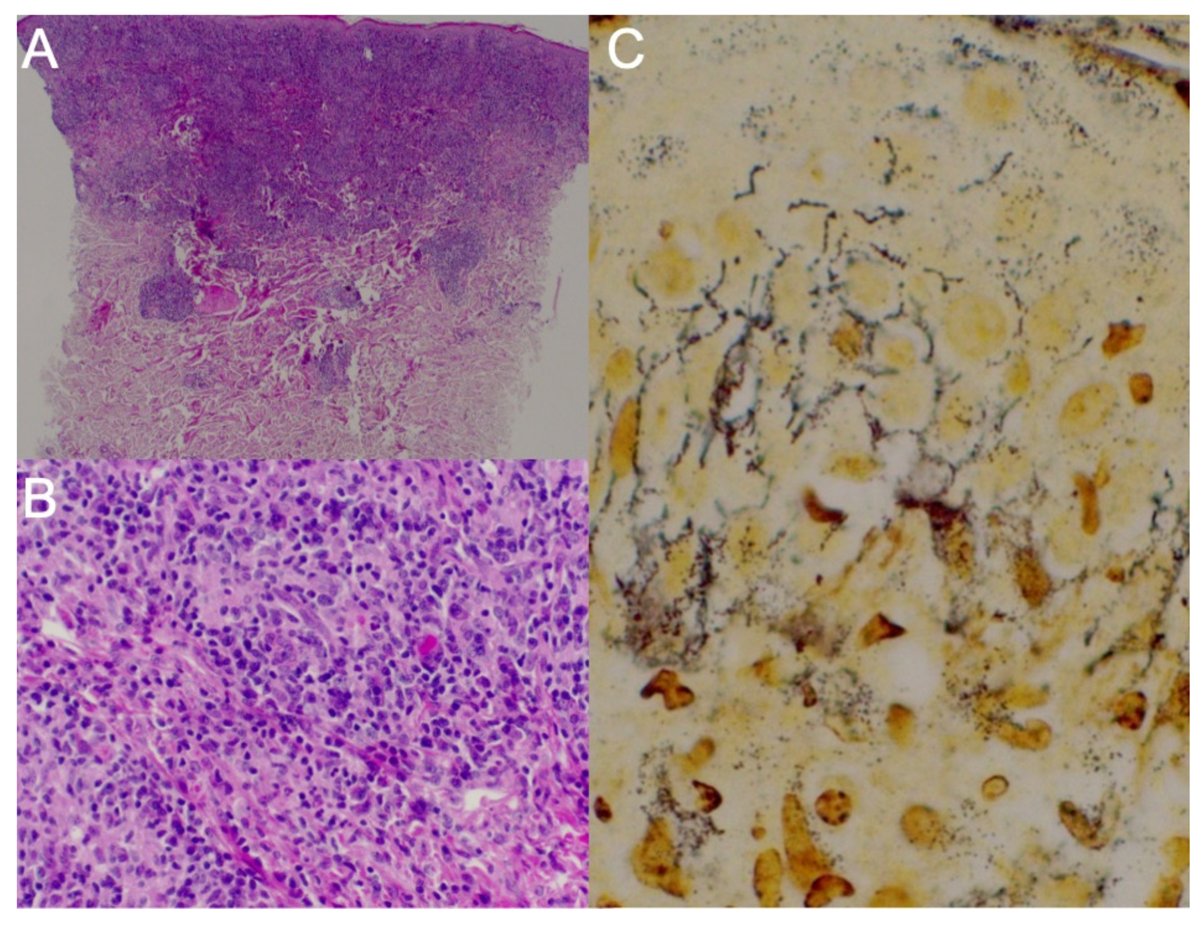 Tropicalmed 07 00047 g002