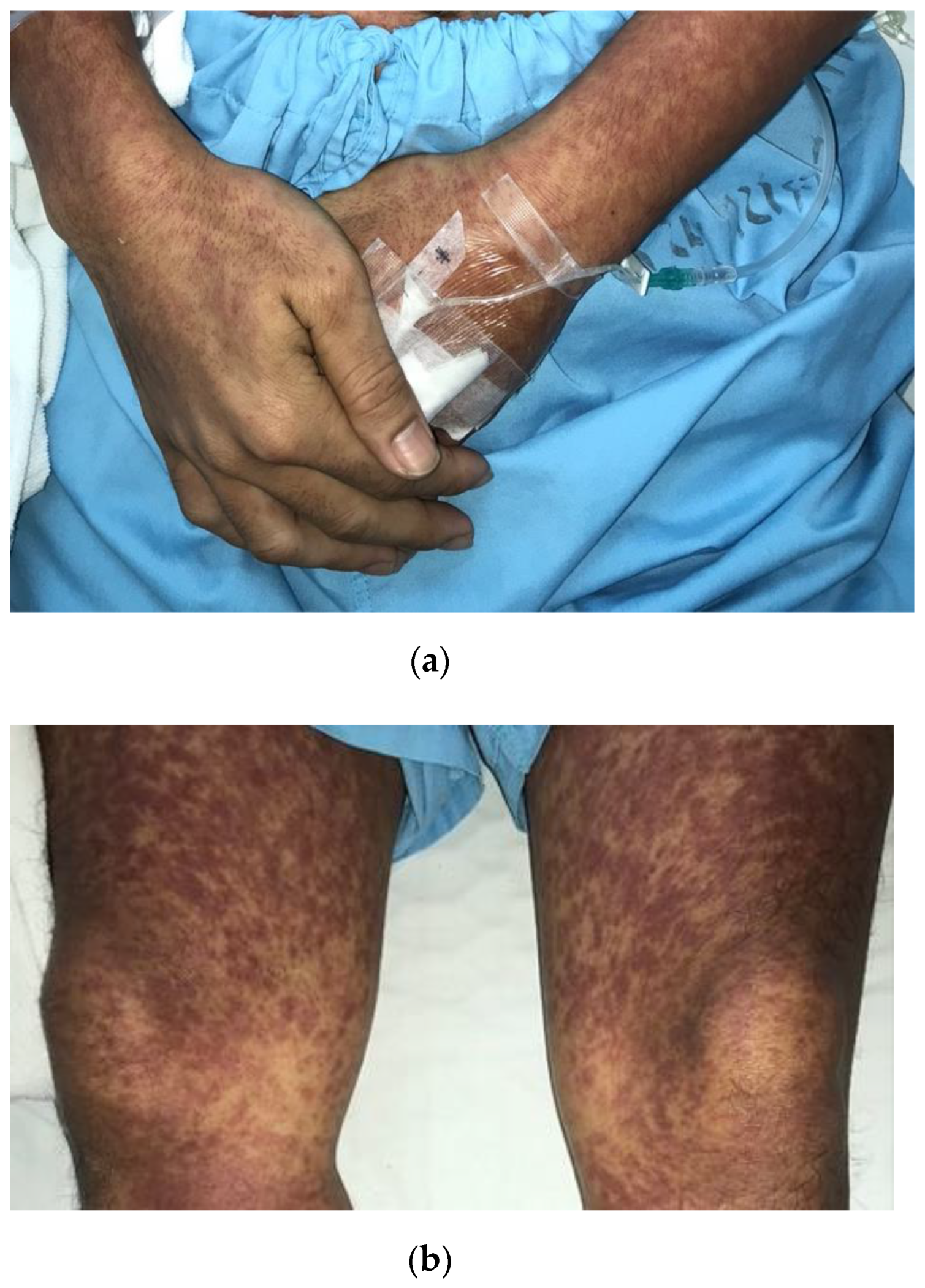 Tropicalmed 07 00070 g001 Tropicalmed 07 00070 g001