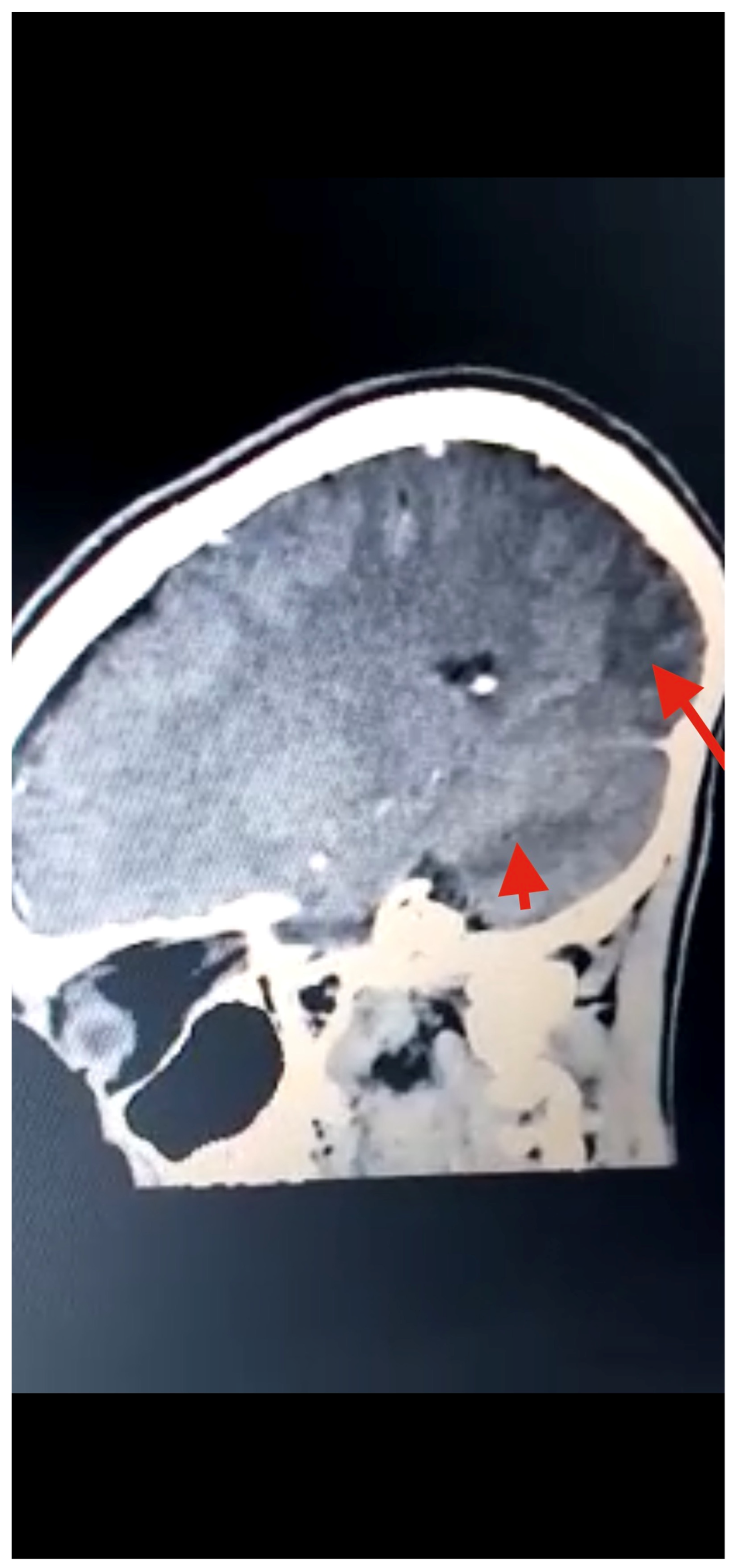 Tropicalmed 07 00096 g003