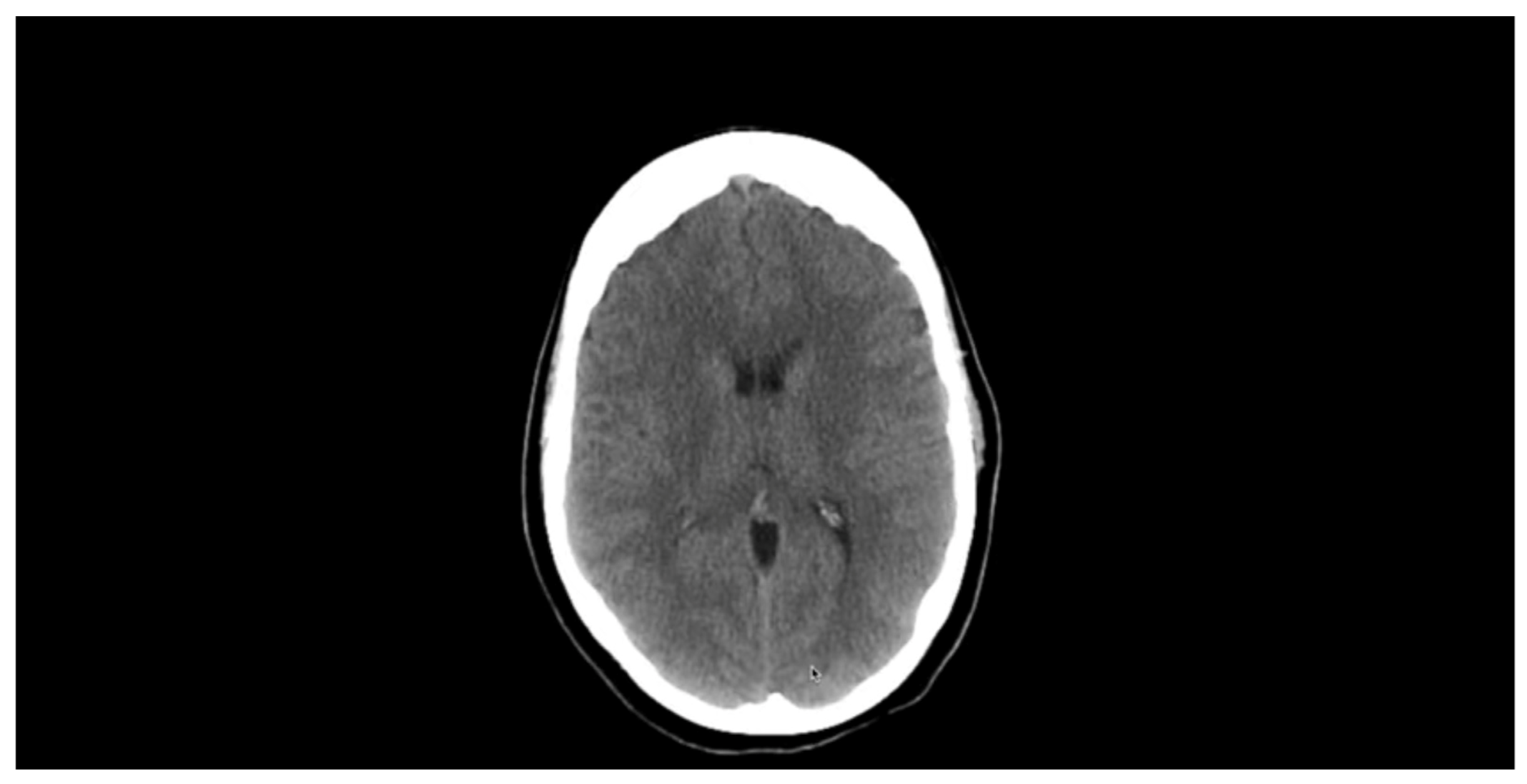 Tropicalmed 07 00096 g004