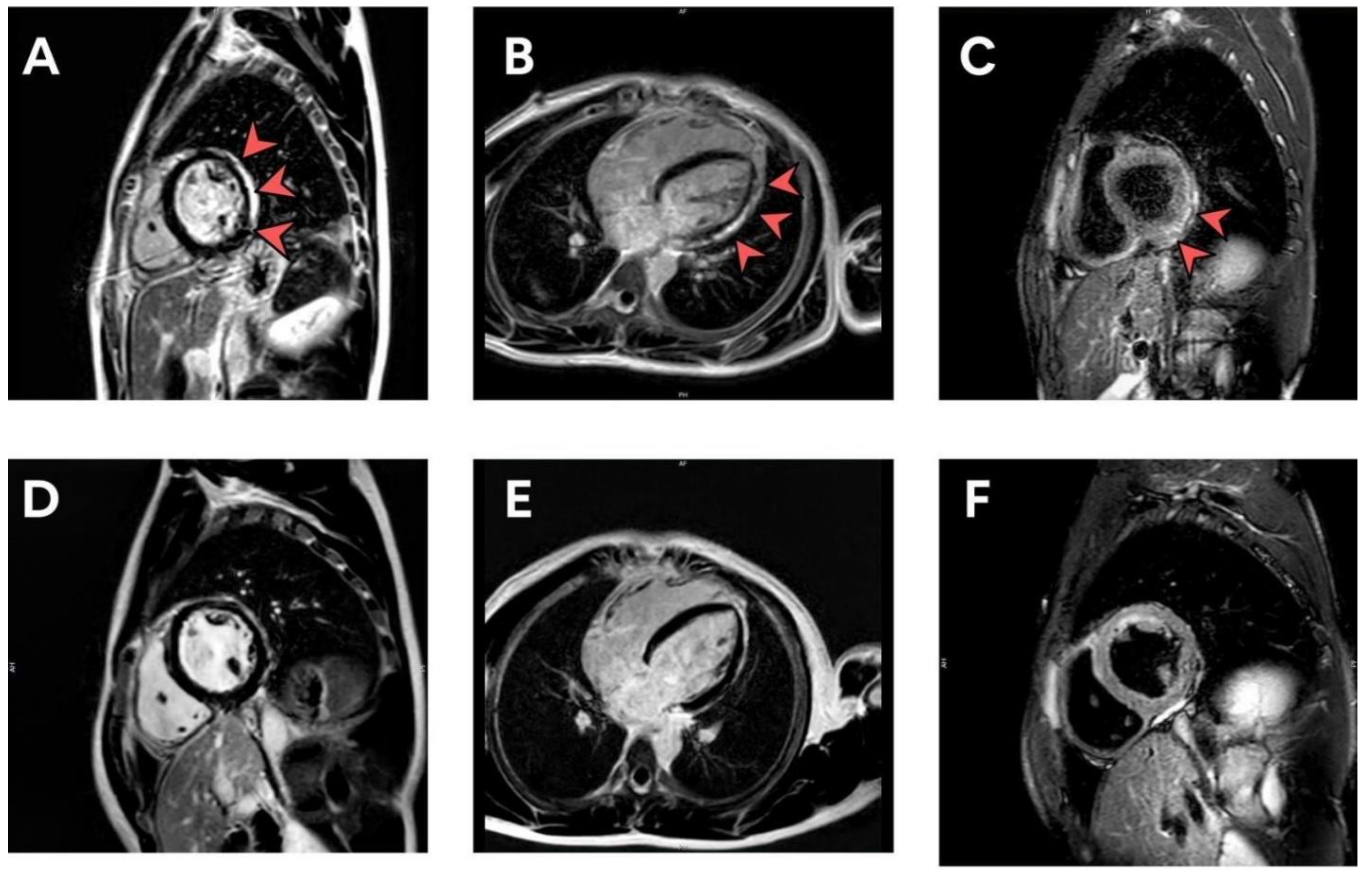 Tropicalmed 07 00196 g002