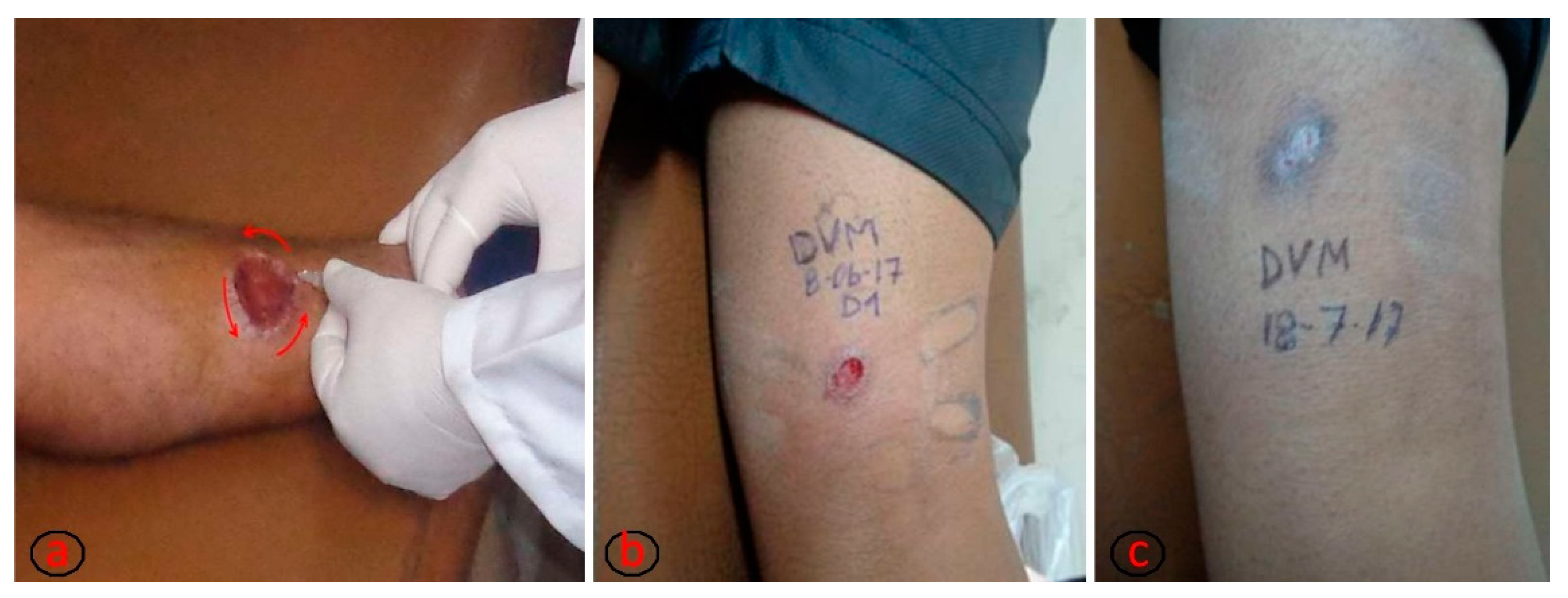 Tropicalmed 07 00286 g001 Tropicalmed 07 00286 g001