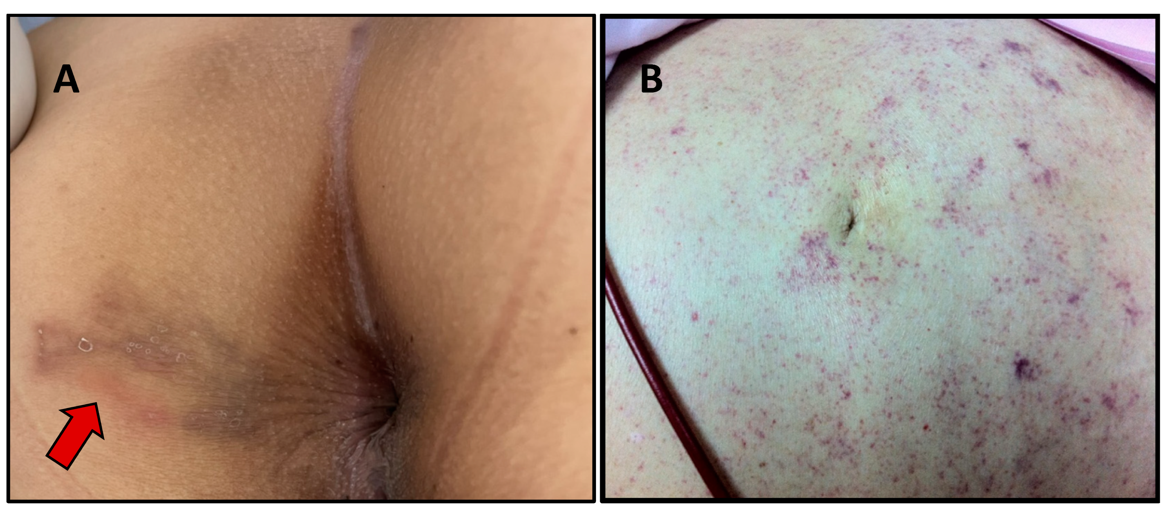 Tropicalmed 07 00310 g003